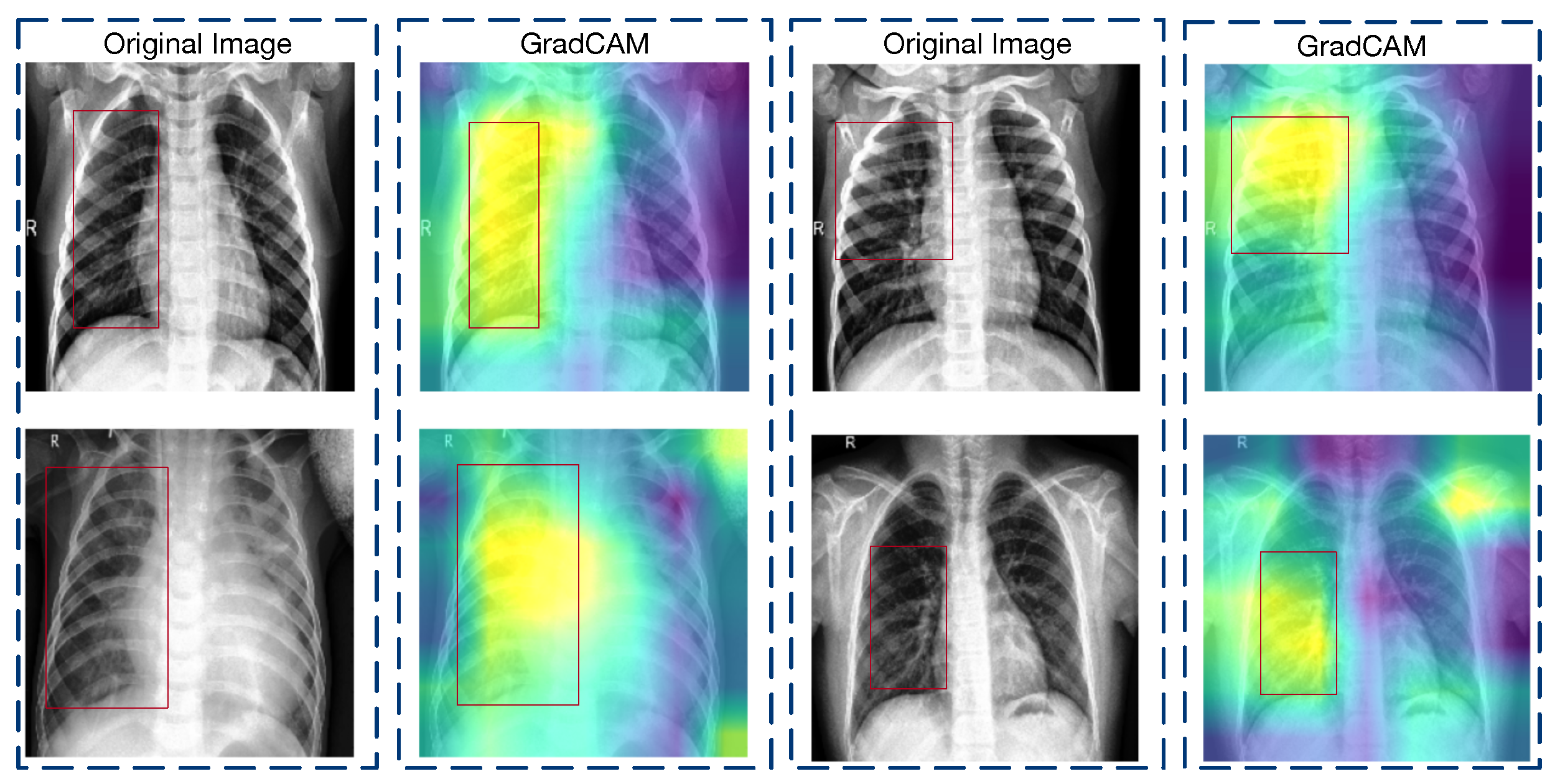Diagnostics 14 00390 g005