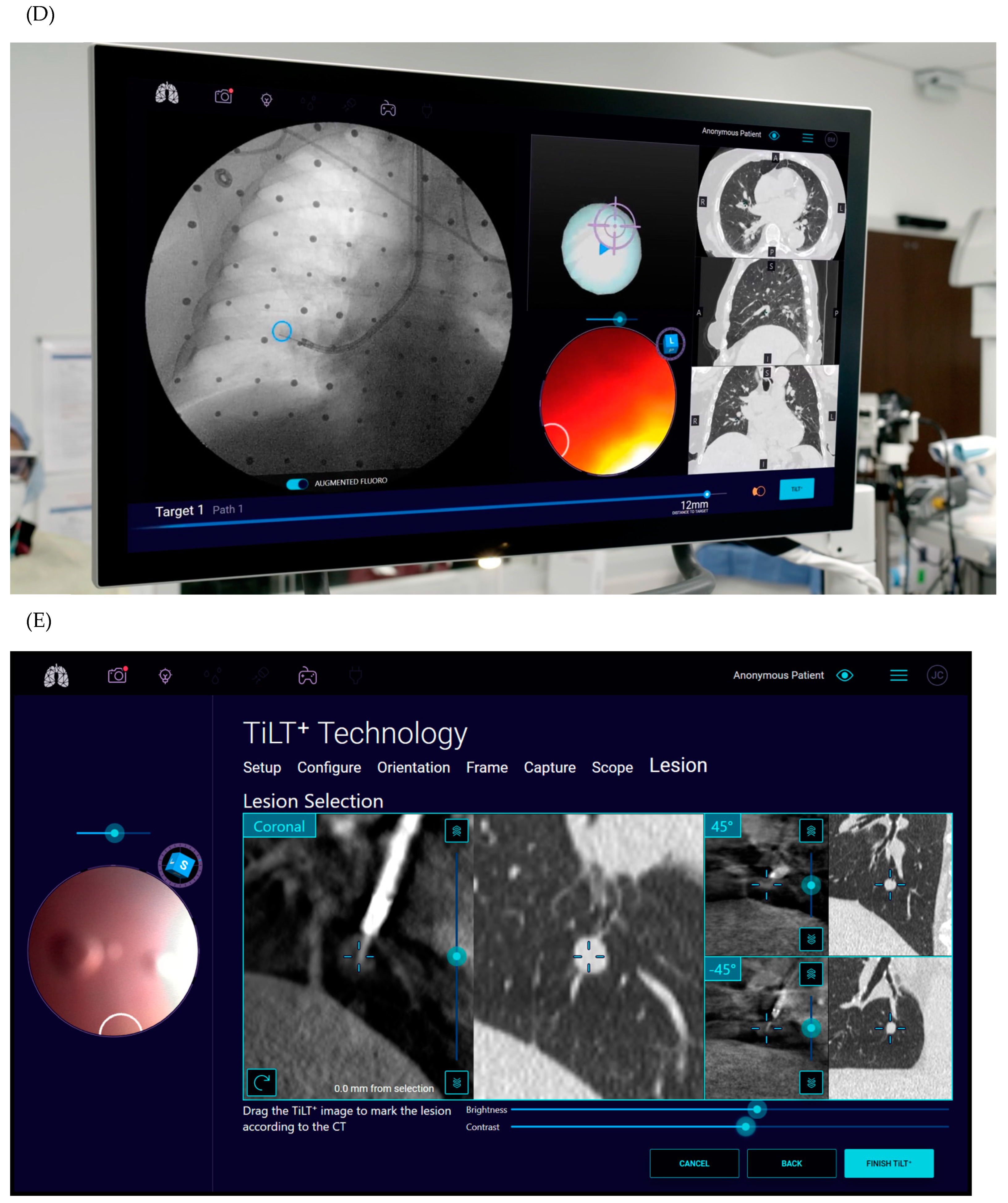 Diagnostics 14 00399 g004b
