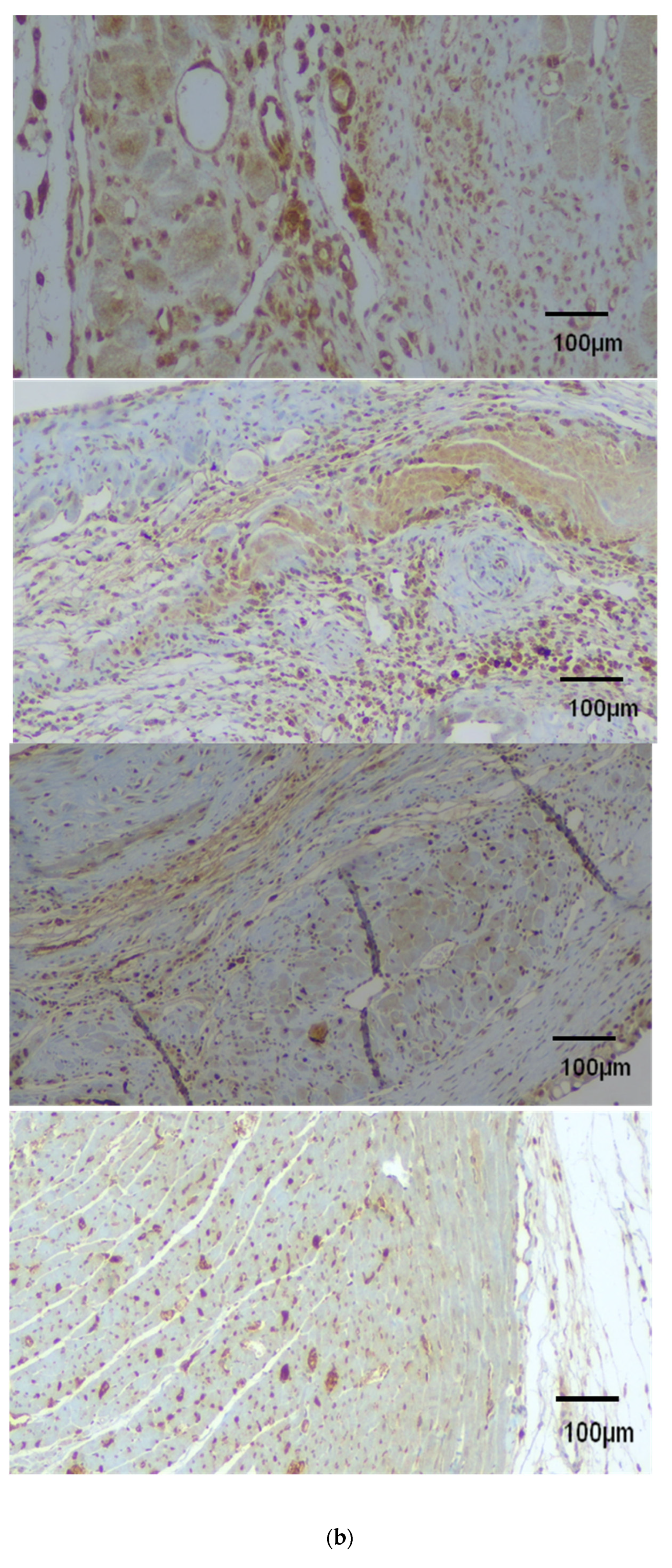 Diagnostics 14 00401 g006b
