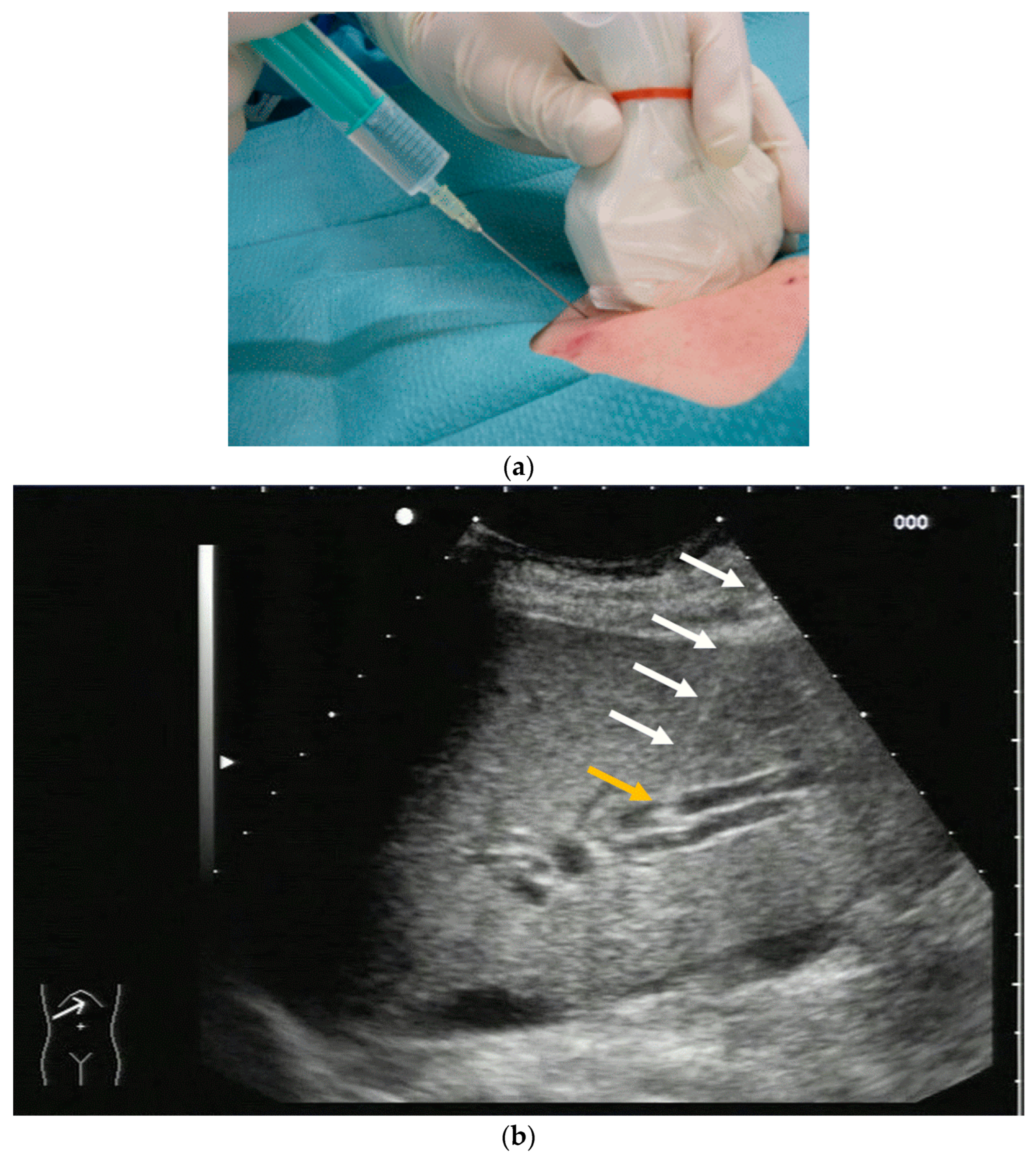 Diagnostics 14 00403 g001