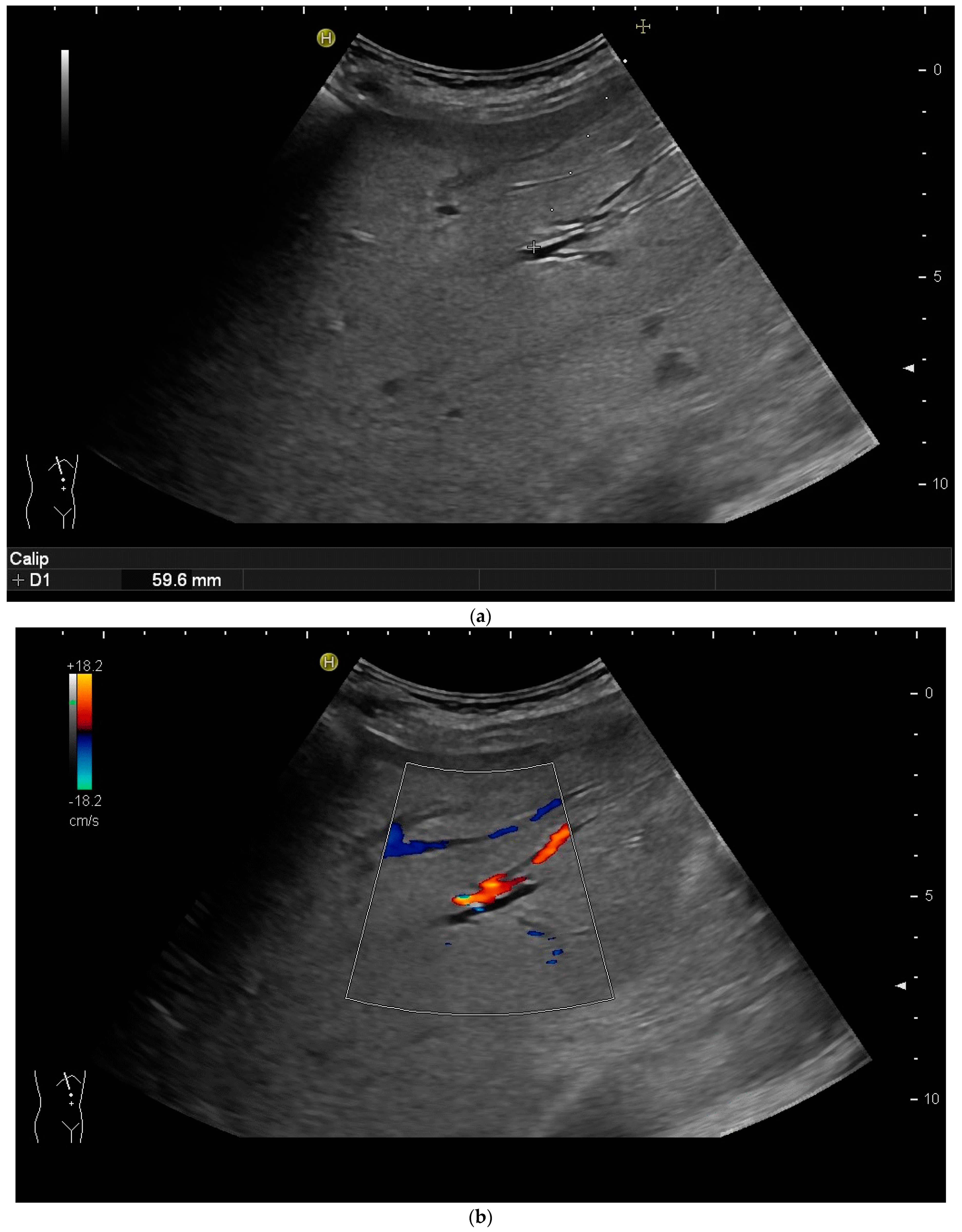 Diagnostics 14 00403 g003