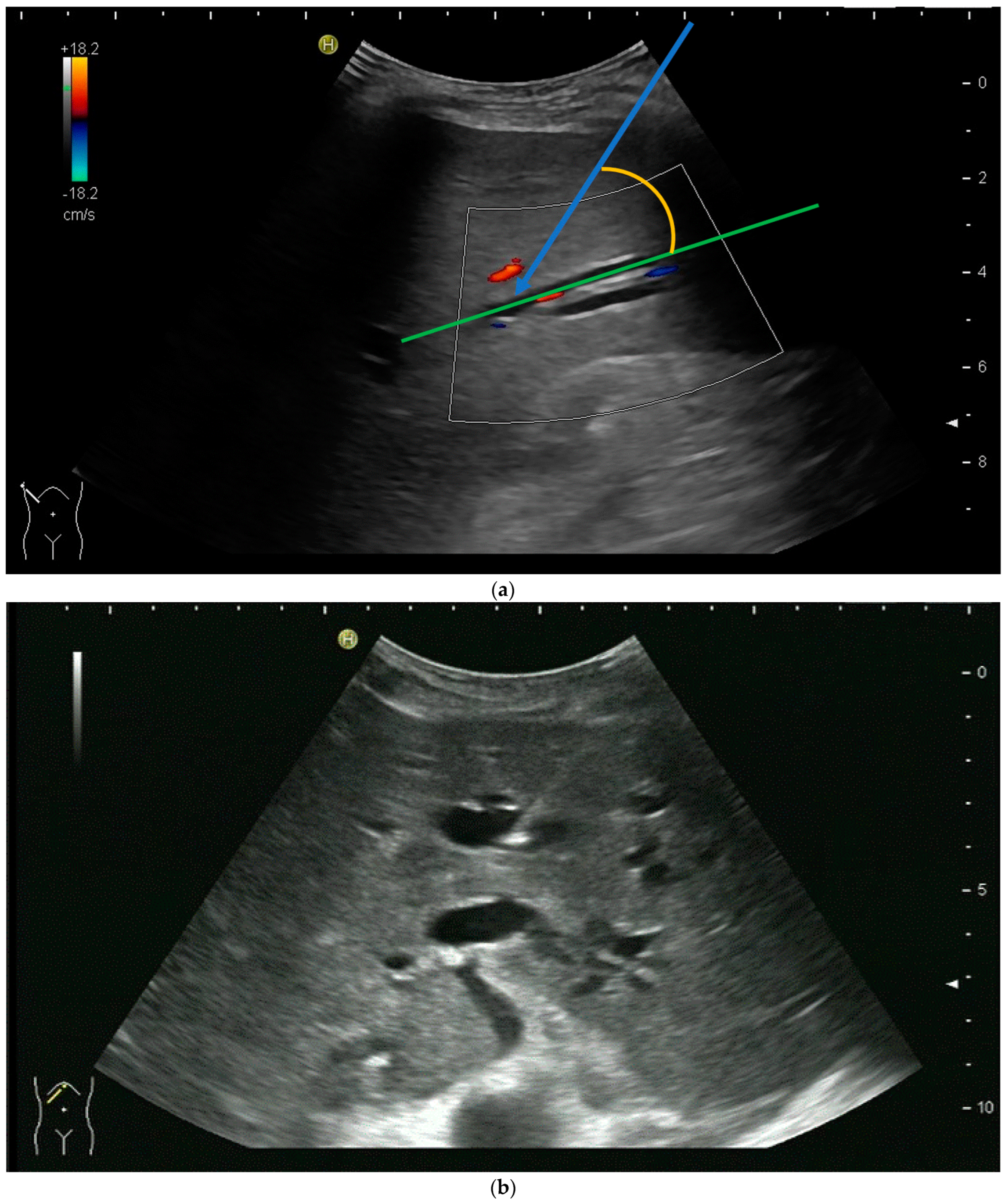 Diagnostics 14 00403 g004a