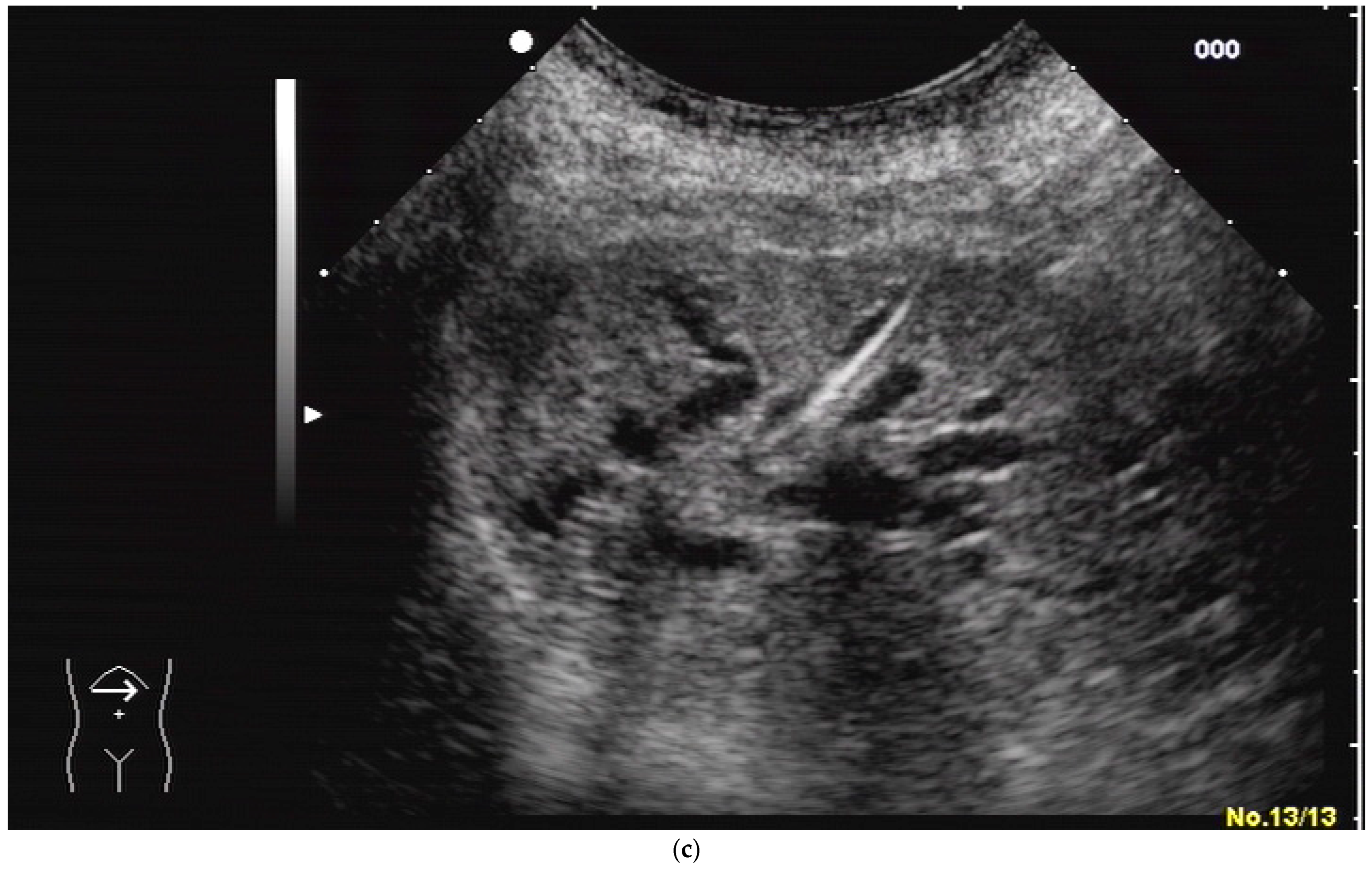 Diagnostics 14 00403 g004b