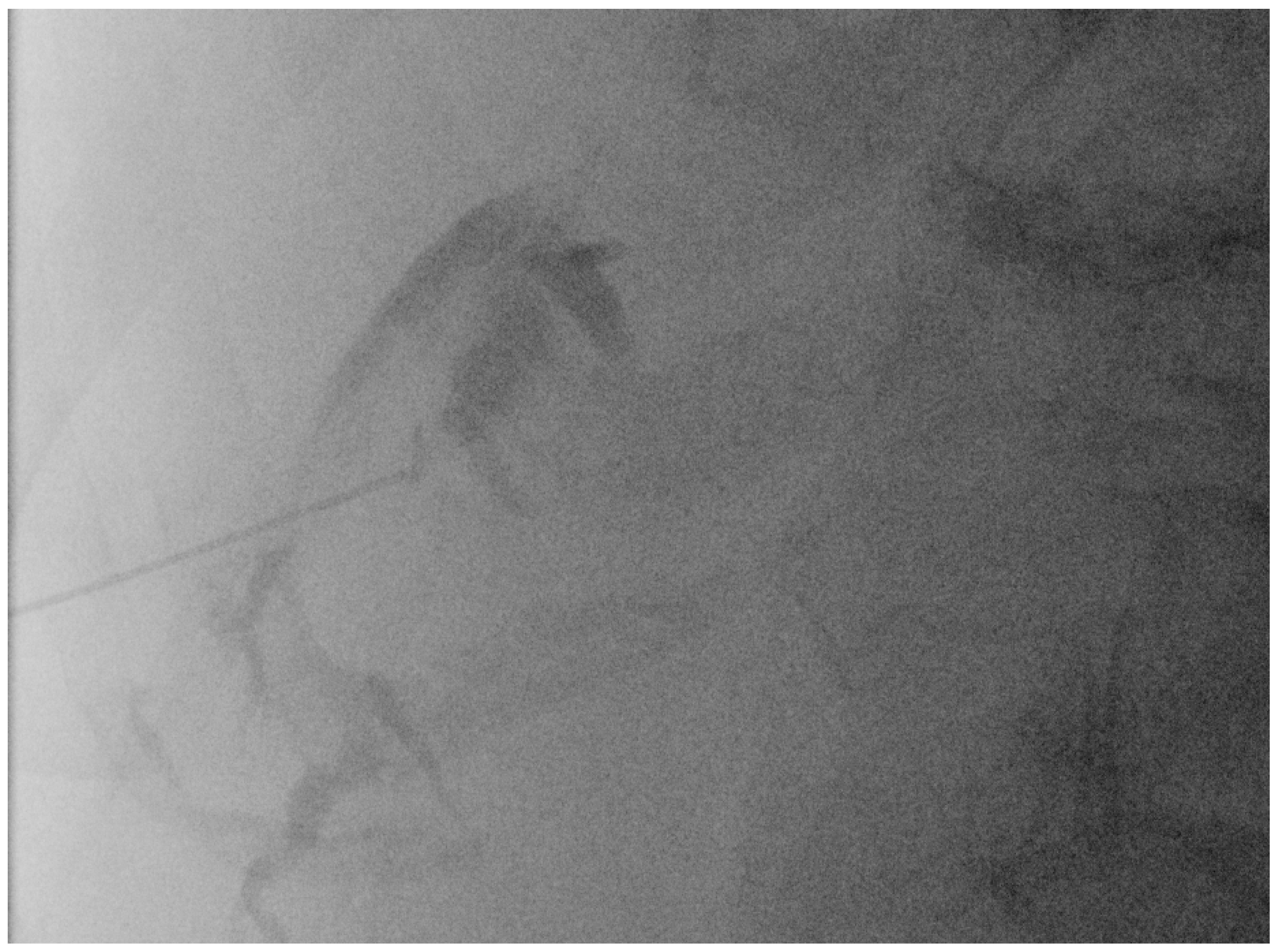 Diagnostics 14 00403 g006