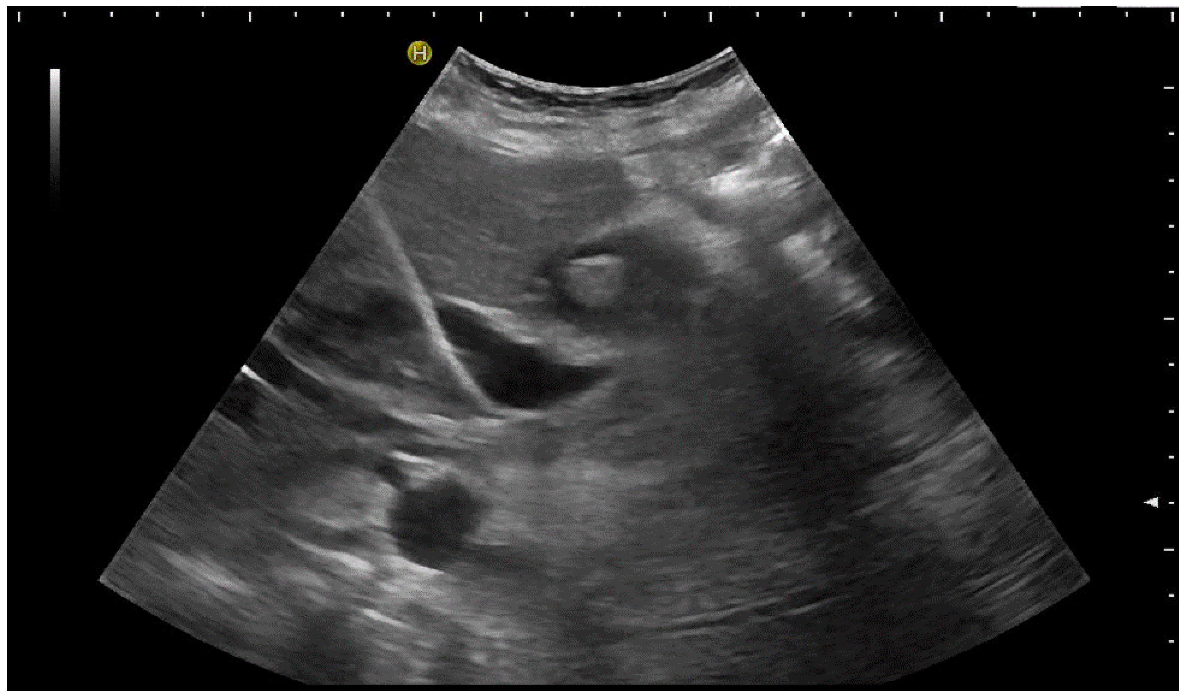 Diagnostics 14 00403 g008