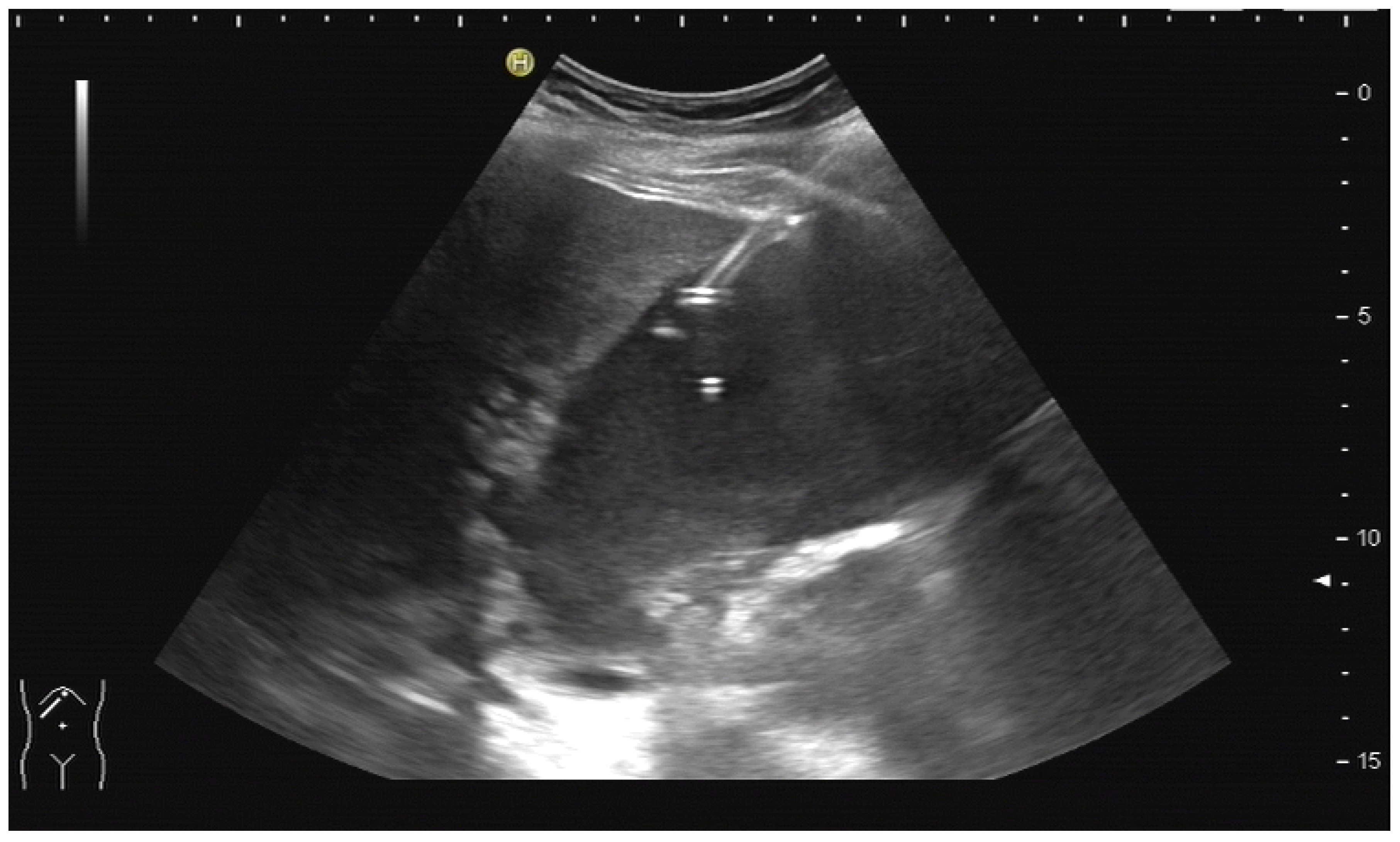 Diagnostics 14 00403 g010