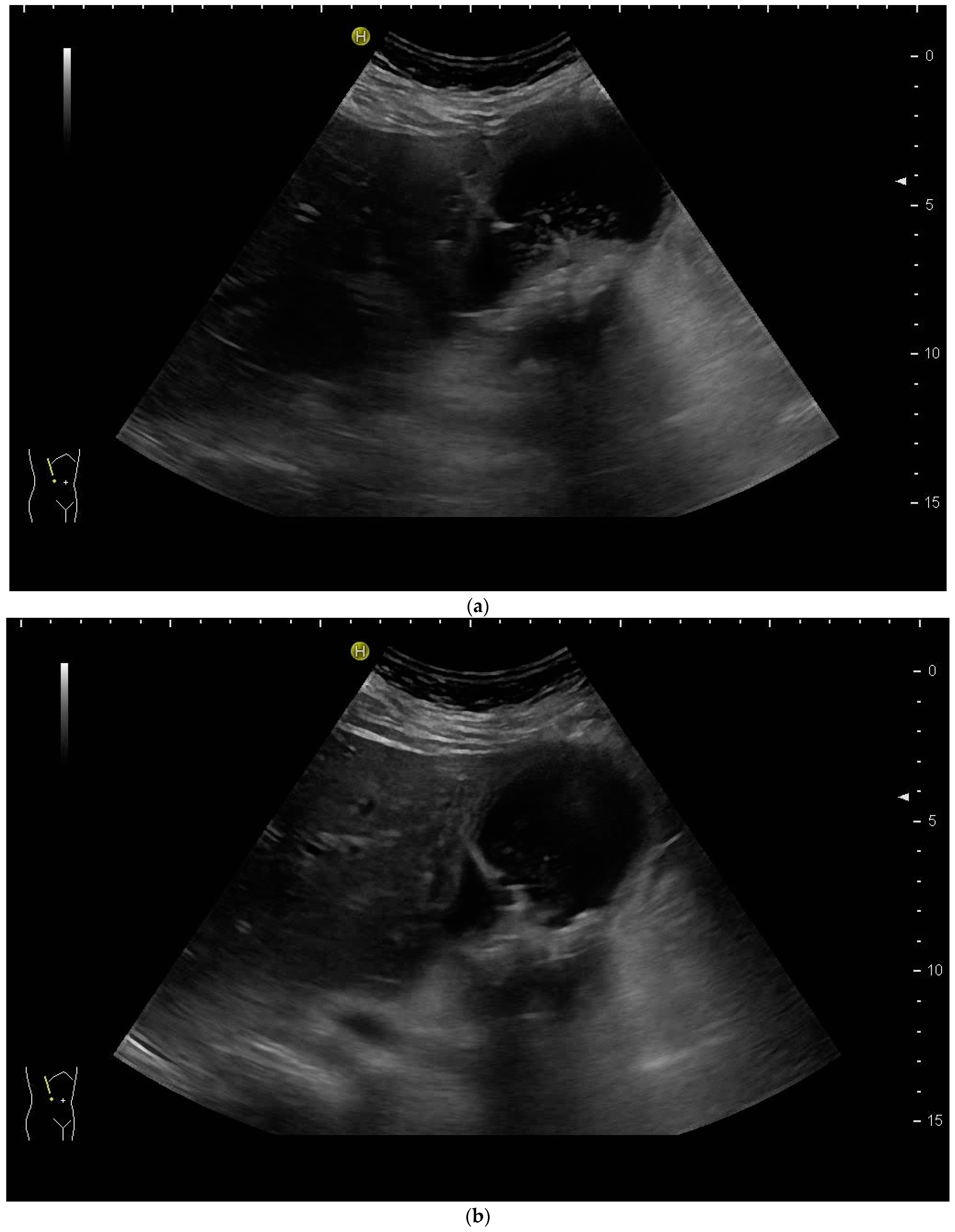Diagnostics 14 00403 g011a