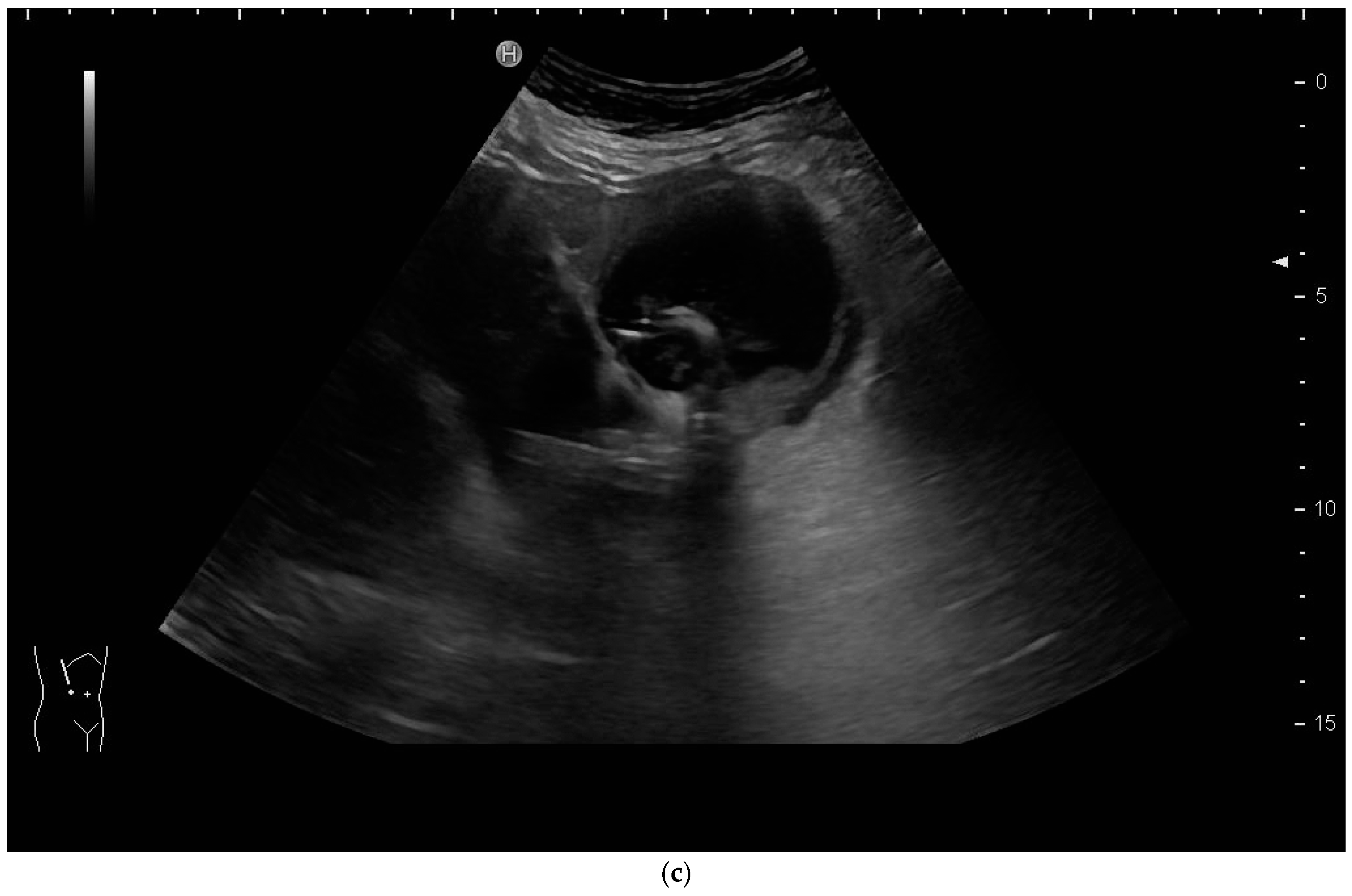 Diagnostics 14 00403 g011b