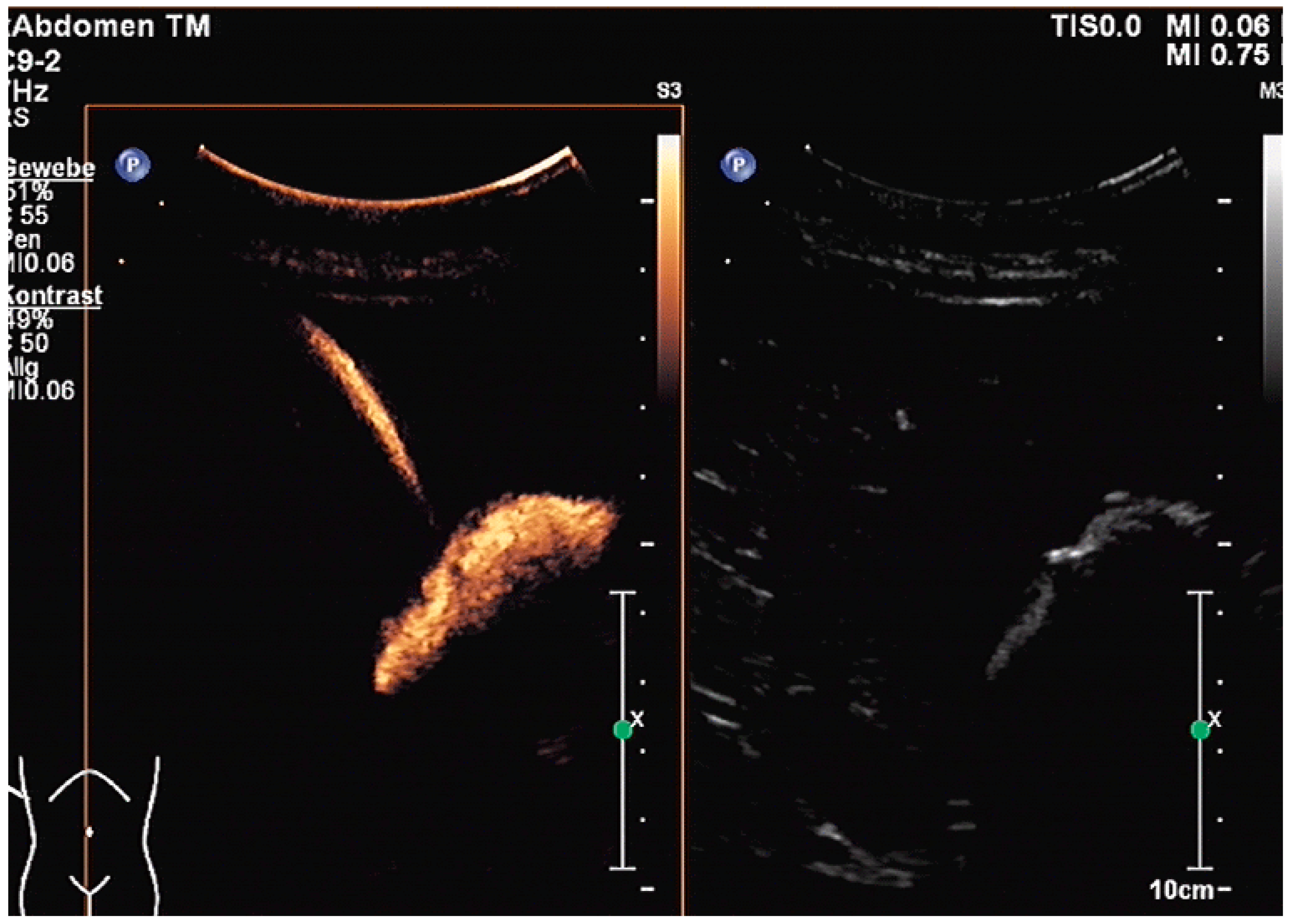 Diagnostics 14 00403 g012