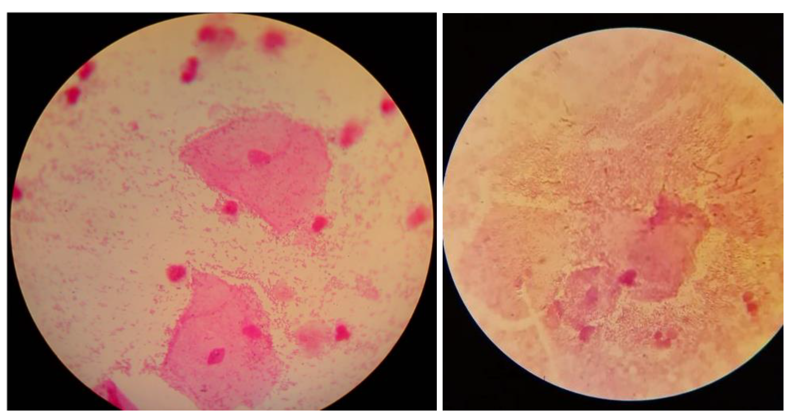 Diagnostics 14 00404 g001 Diagnostics 14 00404 g001