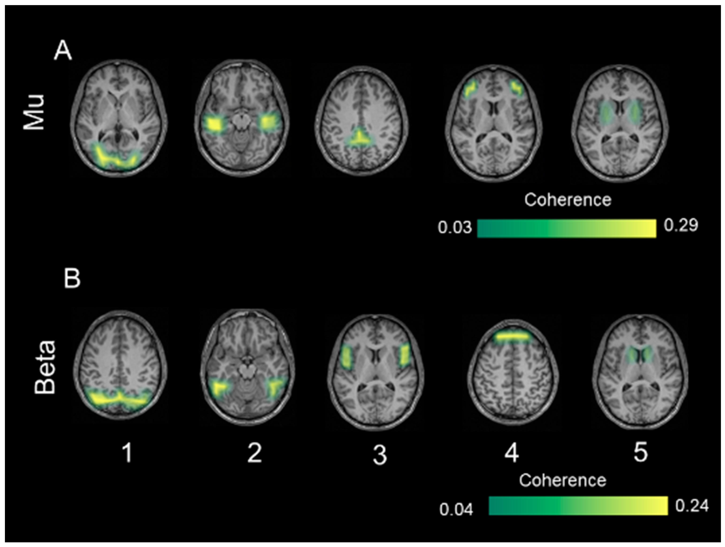Diagnostics 14 00408 g005