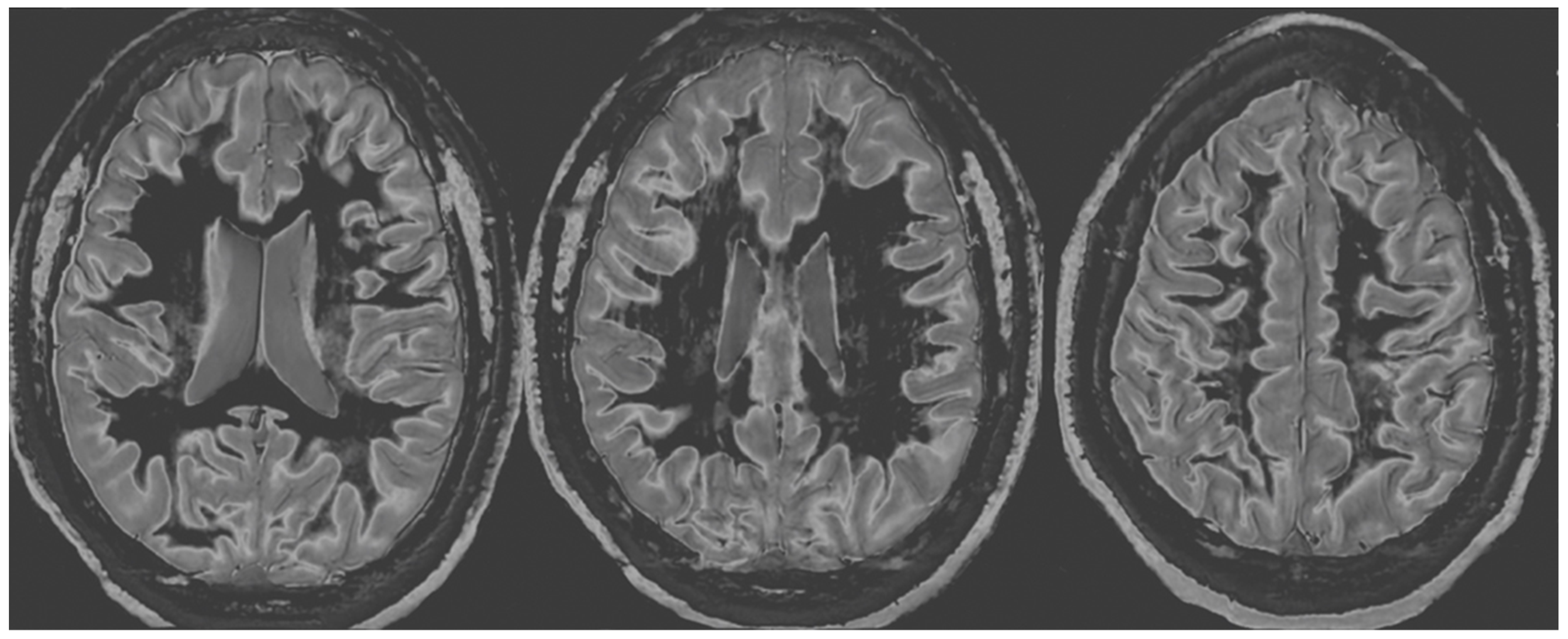 Diagnostics 14 00418 g003