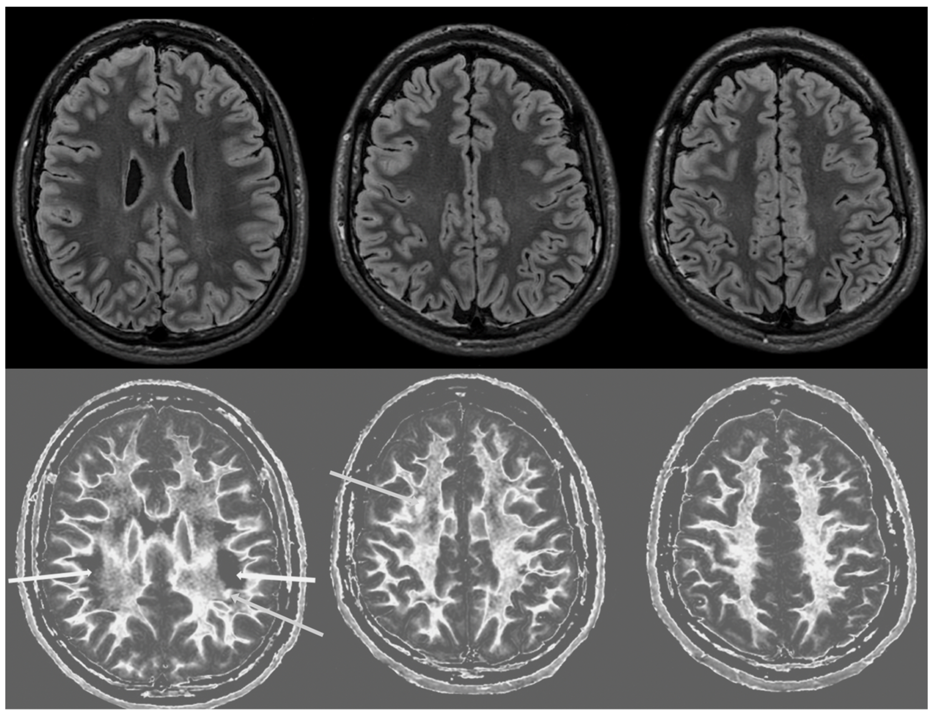 Diagnostics 14 00418 g005