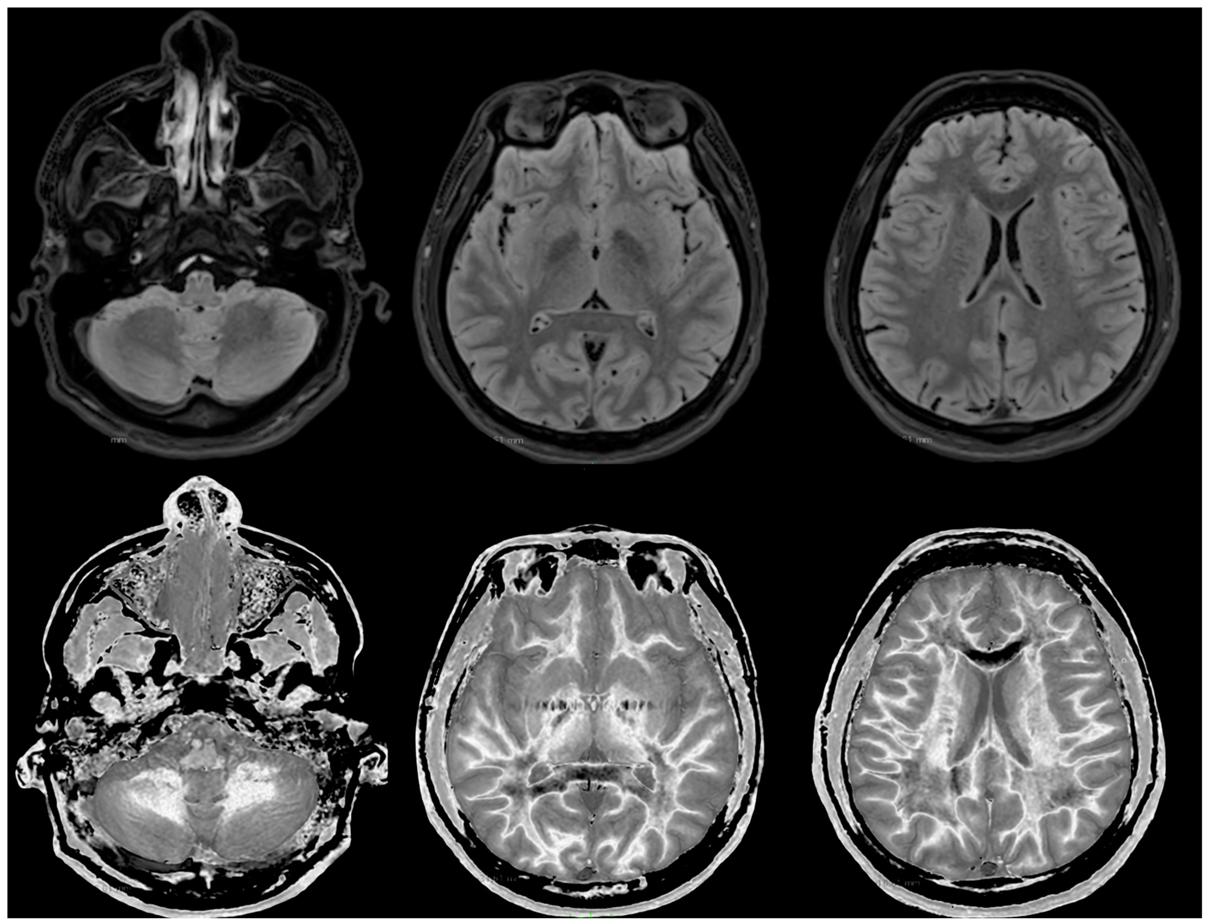 Diagnostics 14 00418 g006