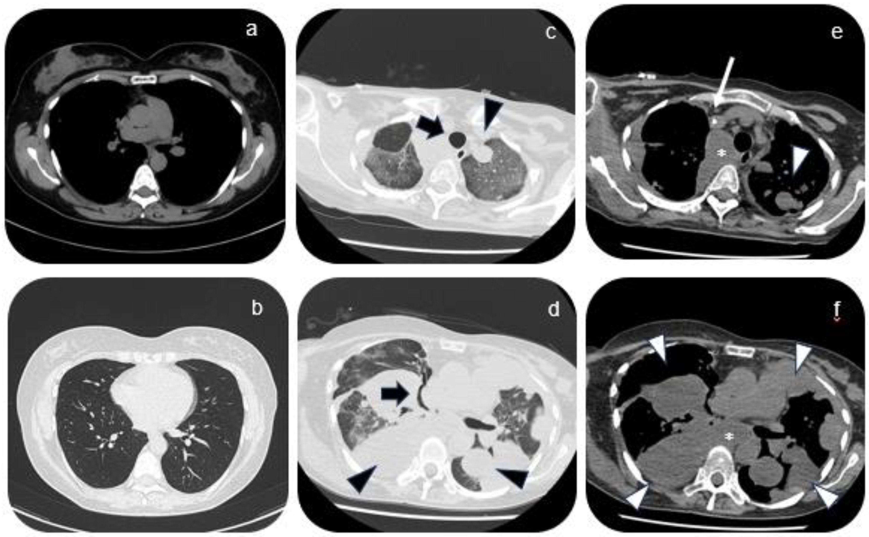 Diagnostics 14 00424 g001