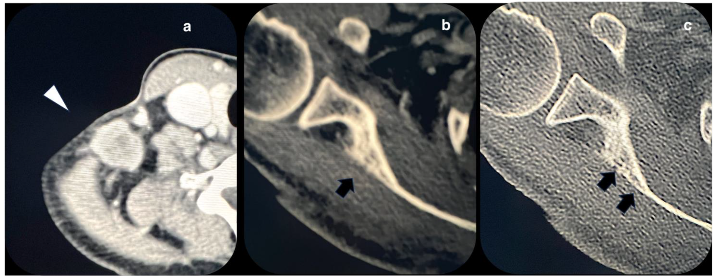 Diagnostics 14 00424 g002