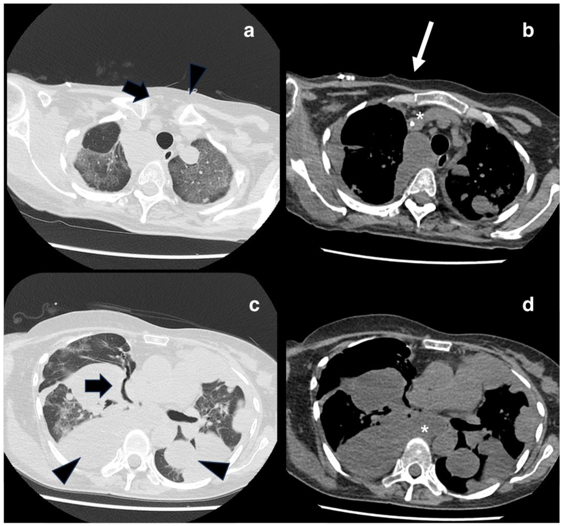 Diagnostics 14 00424 g003