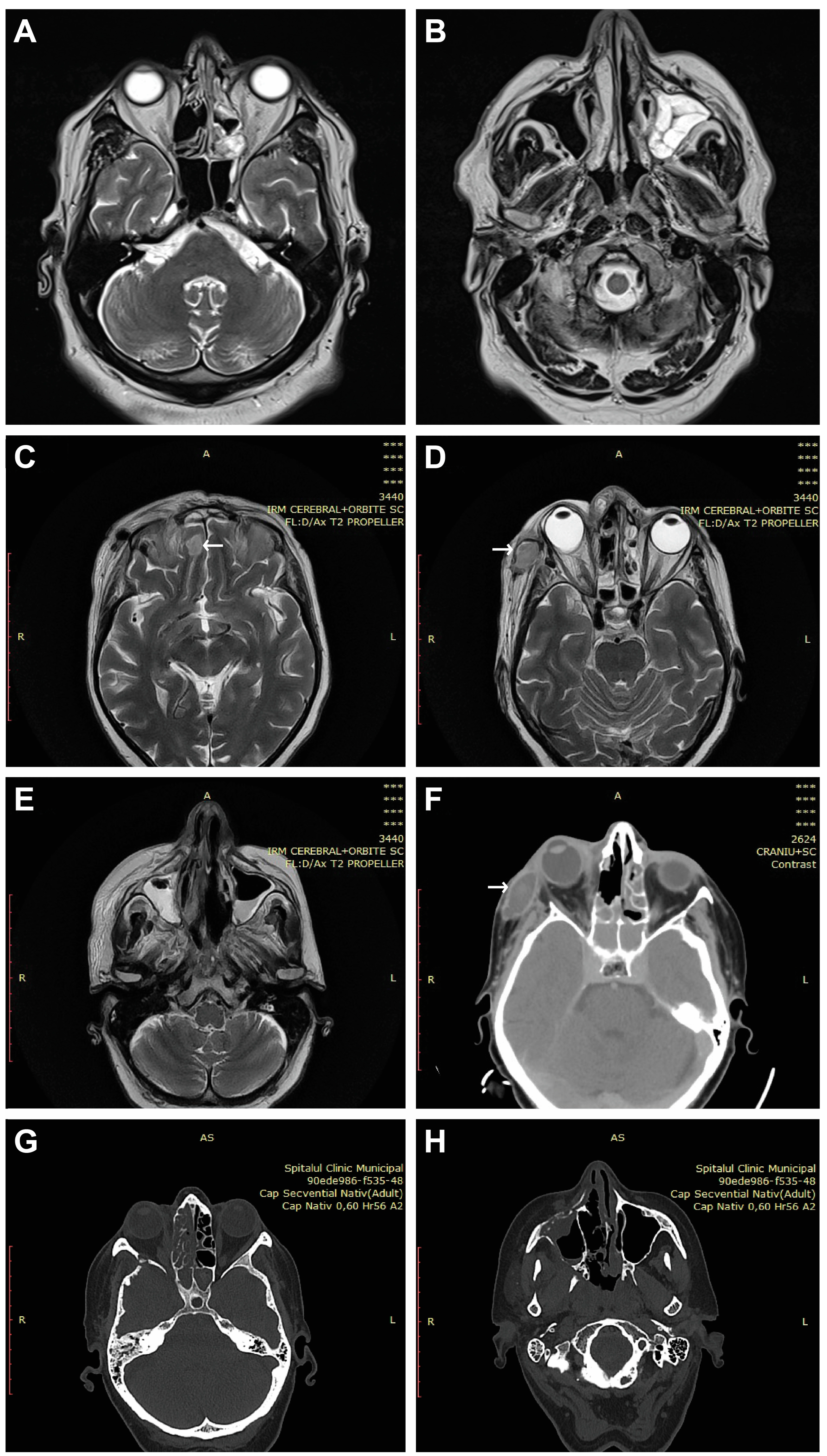 Diagnostics 14 00429 g002