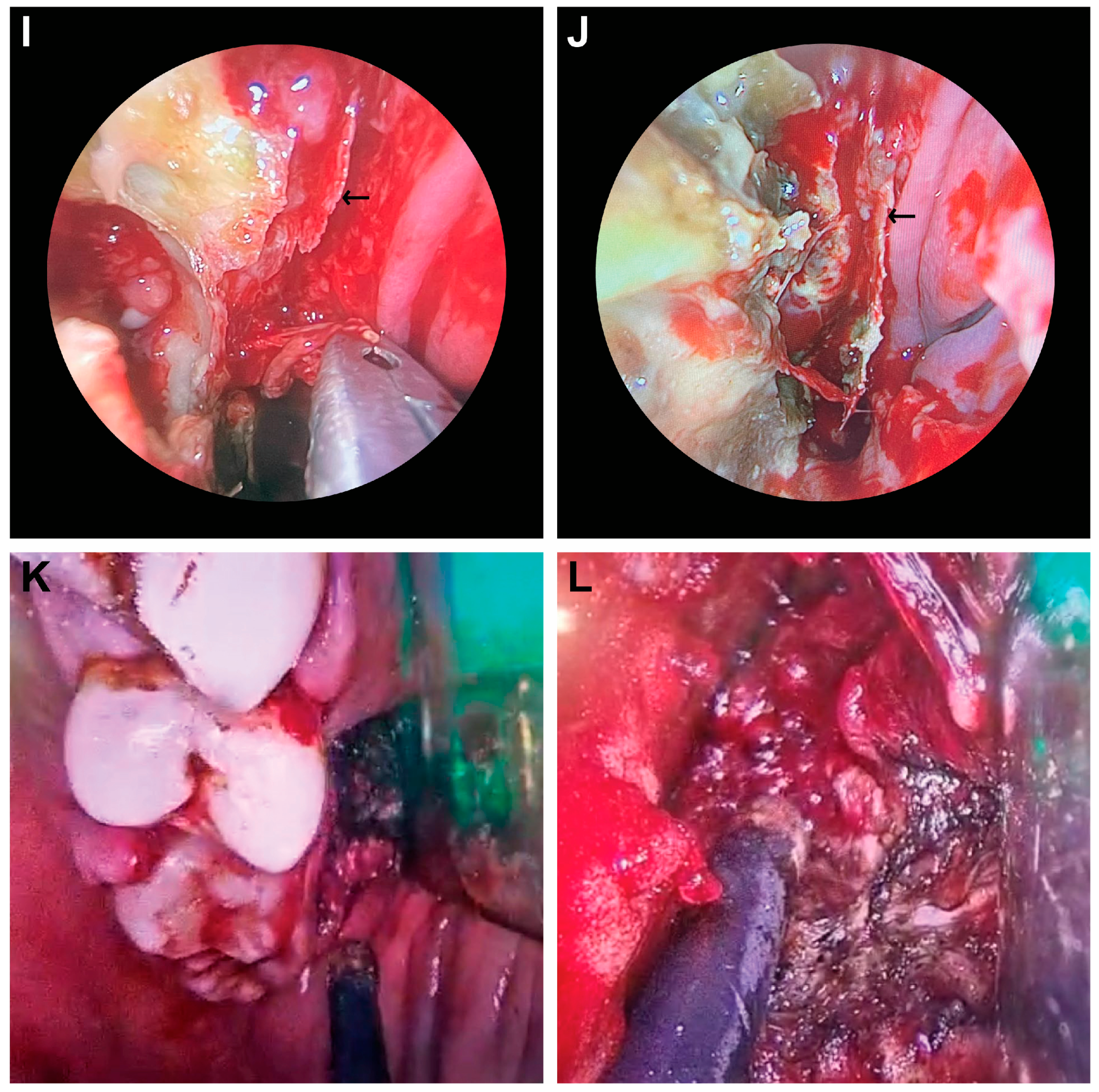 Diagnostics 14 00429 g003b