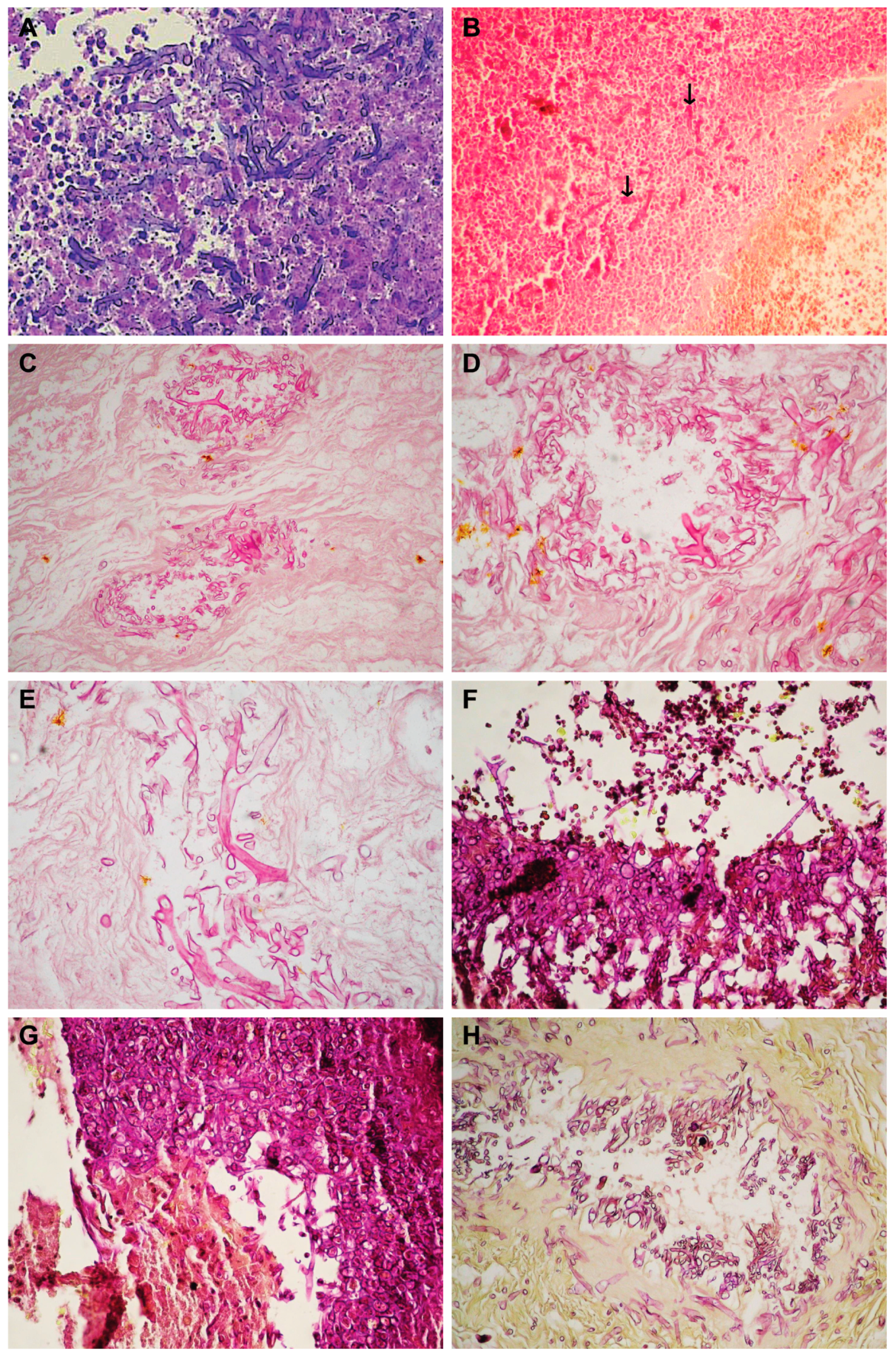 Diagnostics 14 00429 g004a