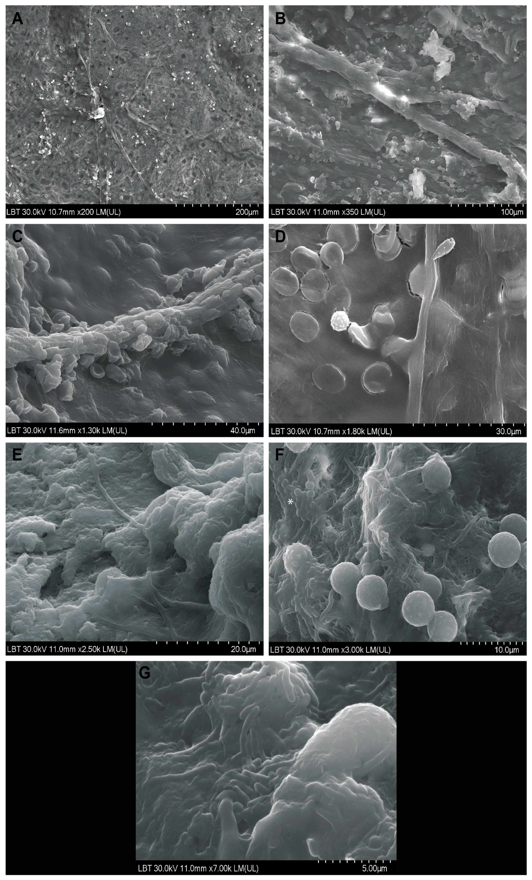 Diagnostics 14 00429 g005