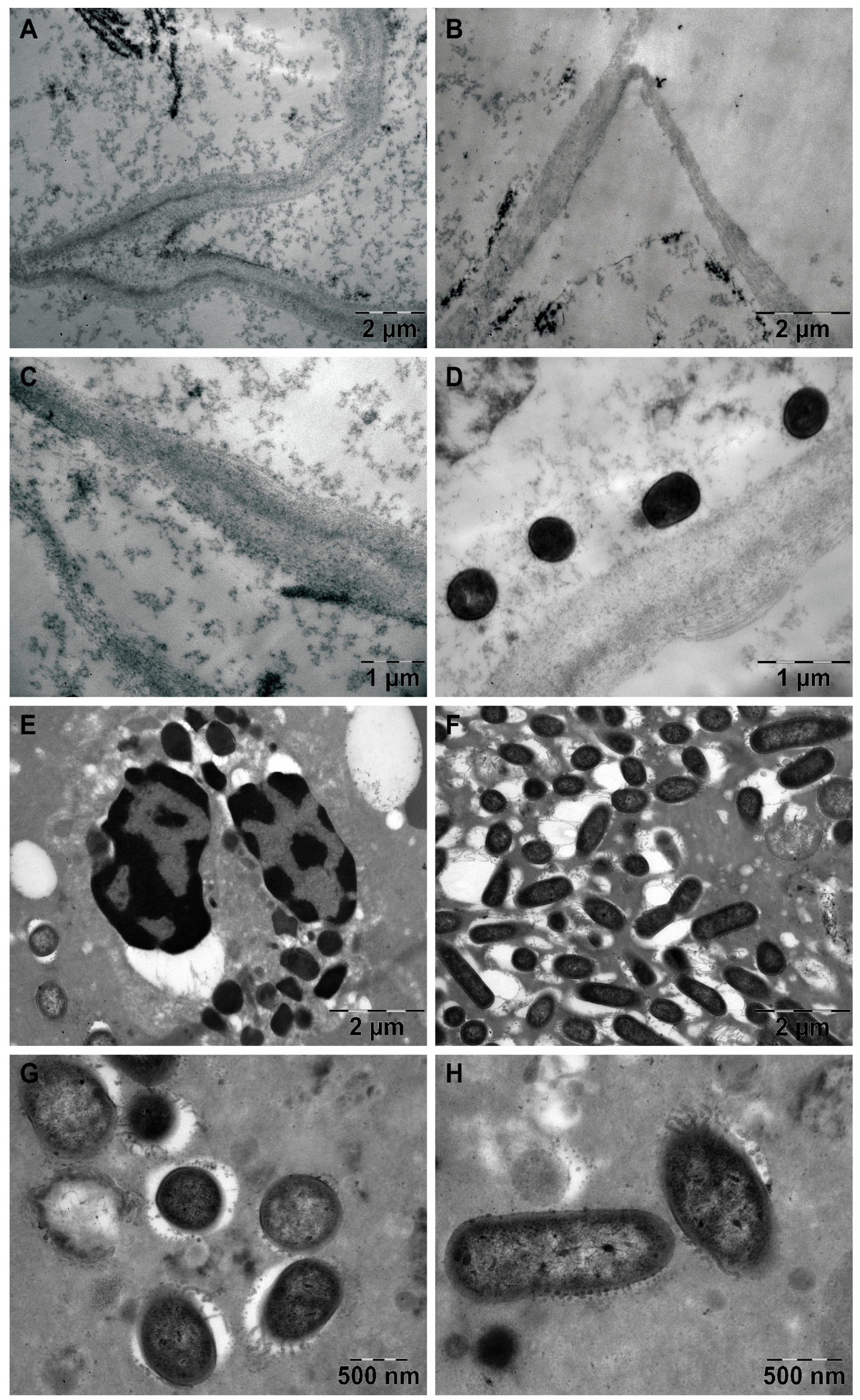 Diagnostics 14 00429 g006