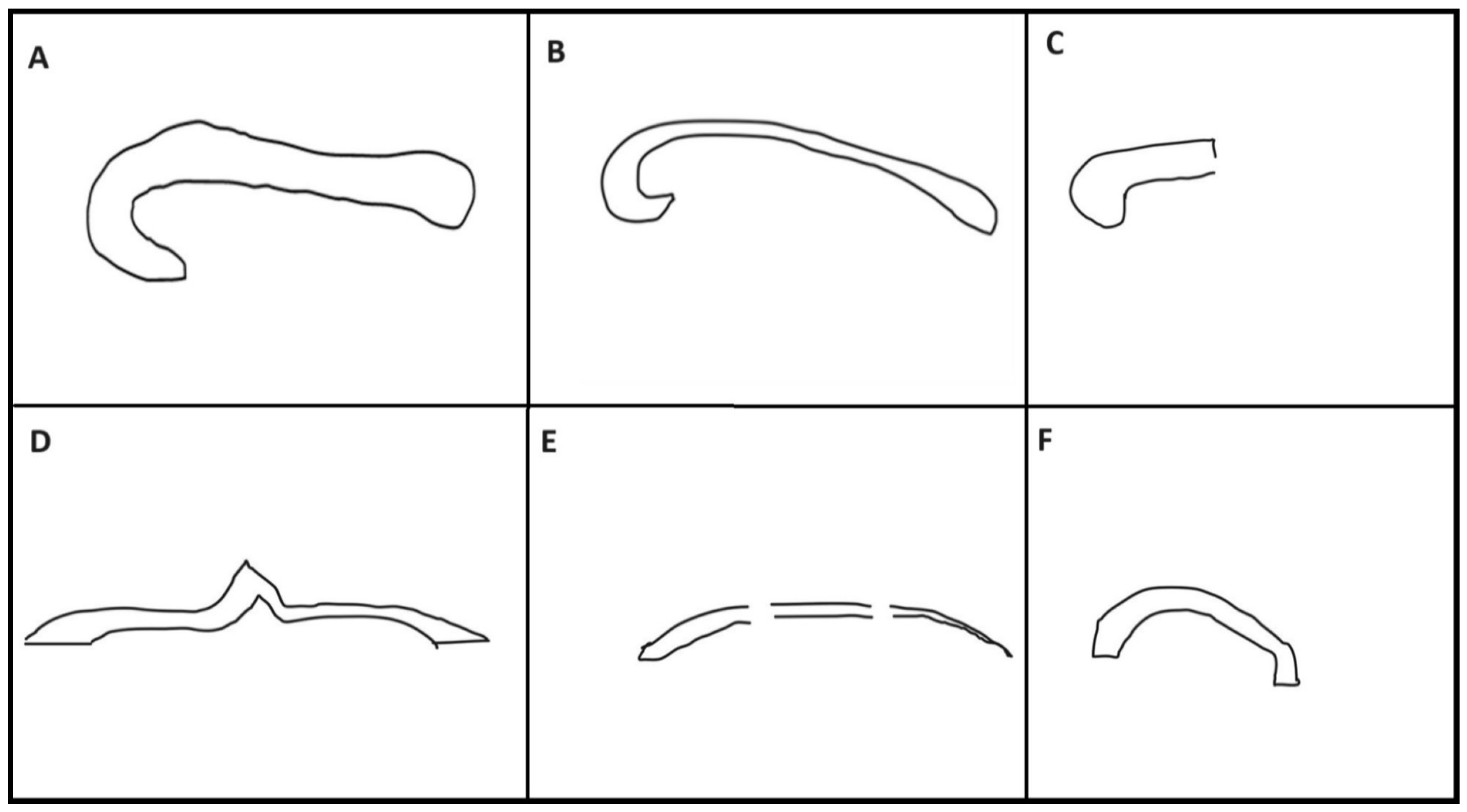 Diagnostics 14 00430 g001