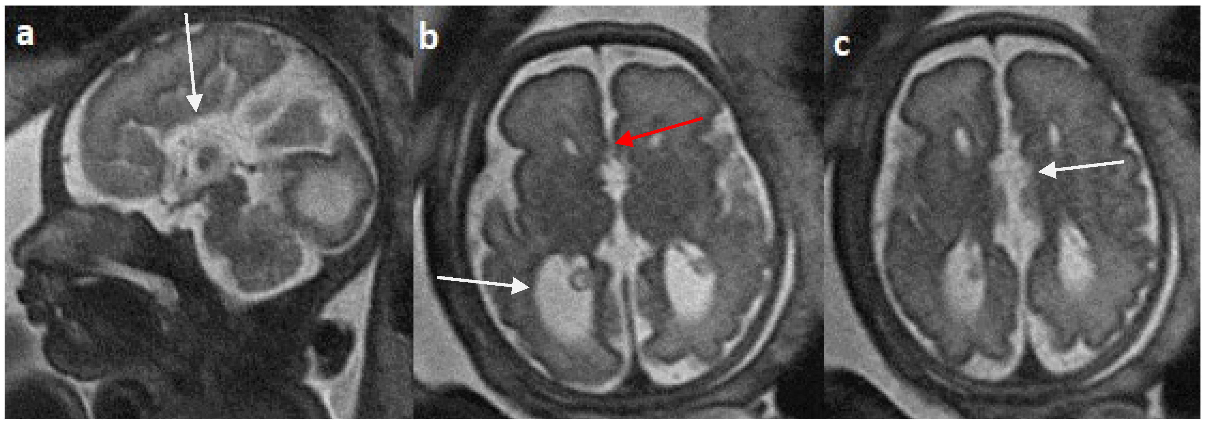 Diagnostics 14 00430 g005