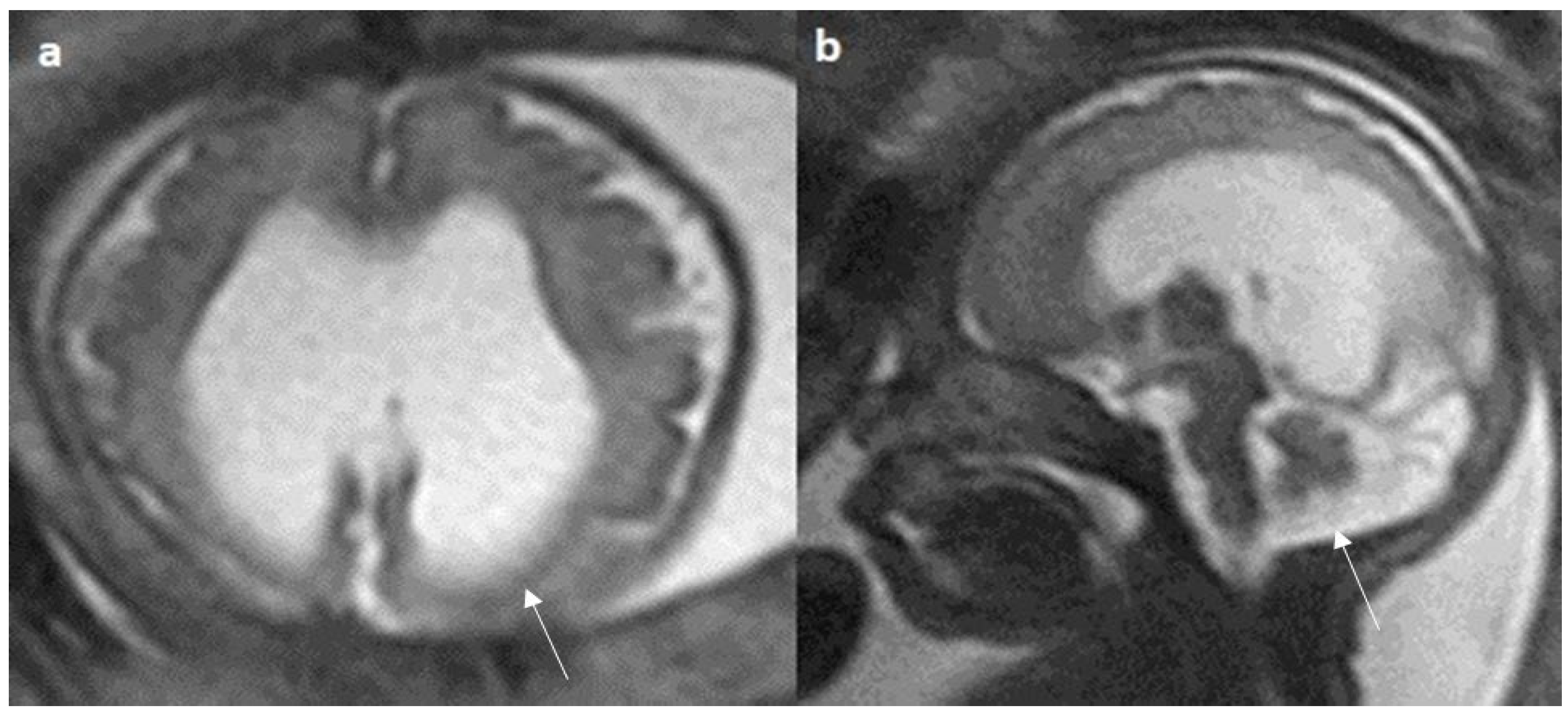 Diagnostics 14 00430 g006
