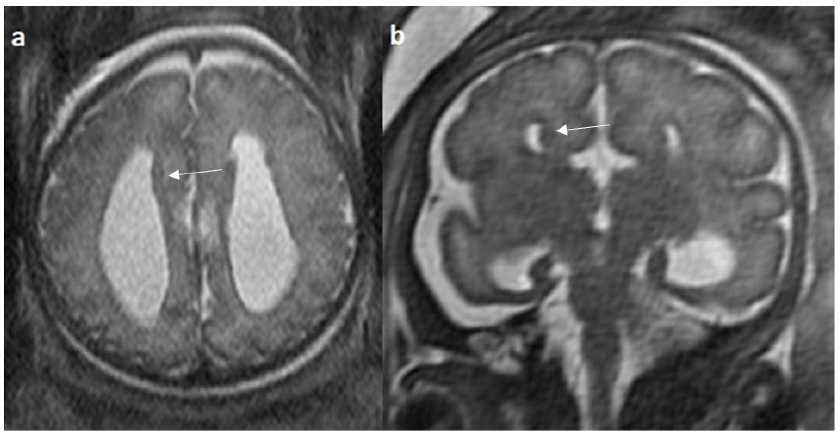 Diagnostics 14 00430 g007