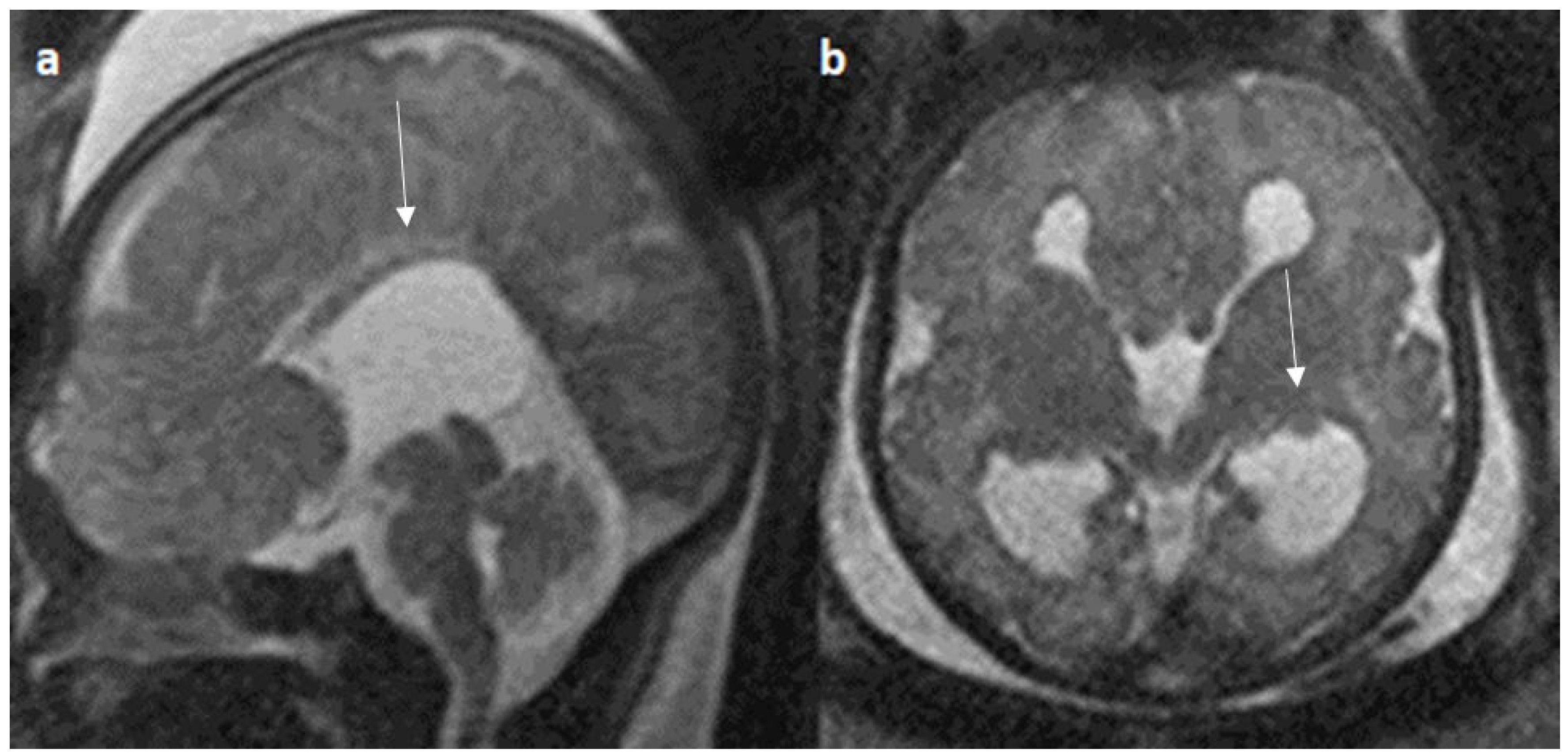 Diagnostics 14 00430 g008