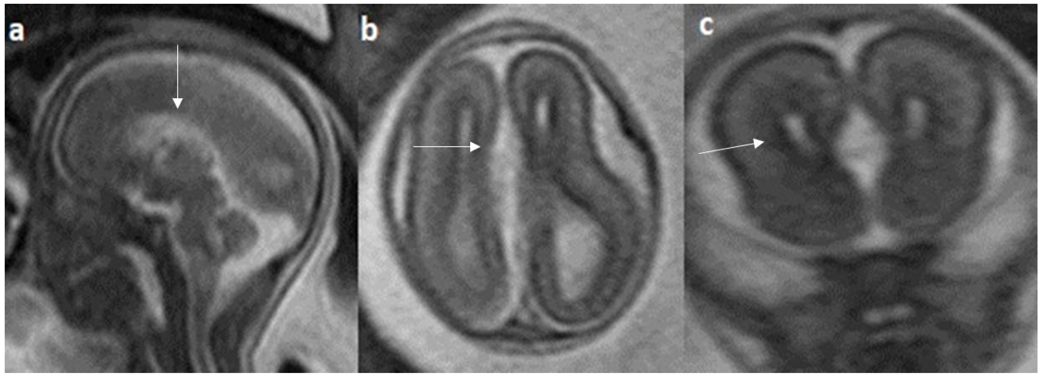 Diagnostics 14 00430 g009