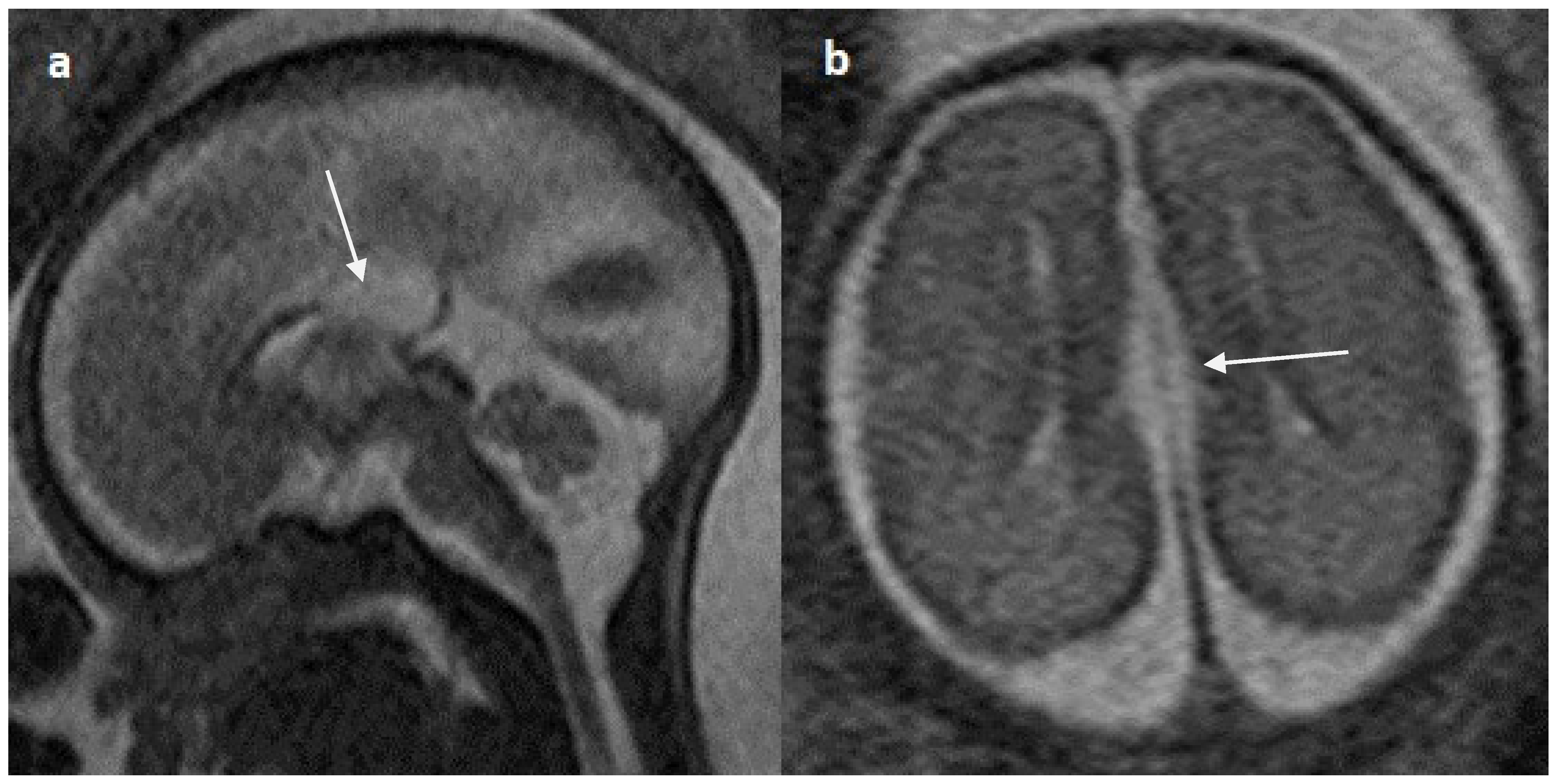 Diagnostics 14 00430 g010