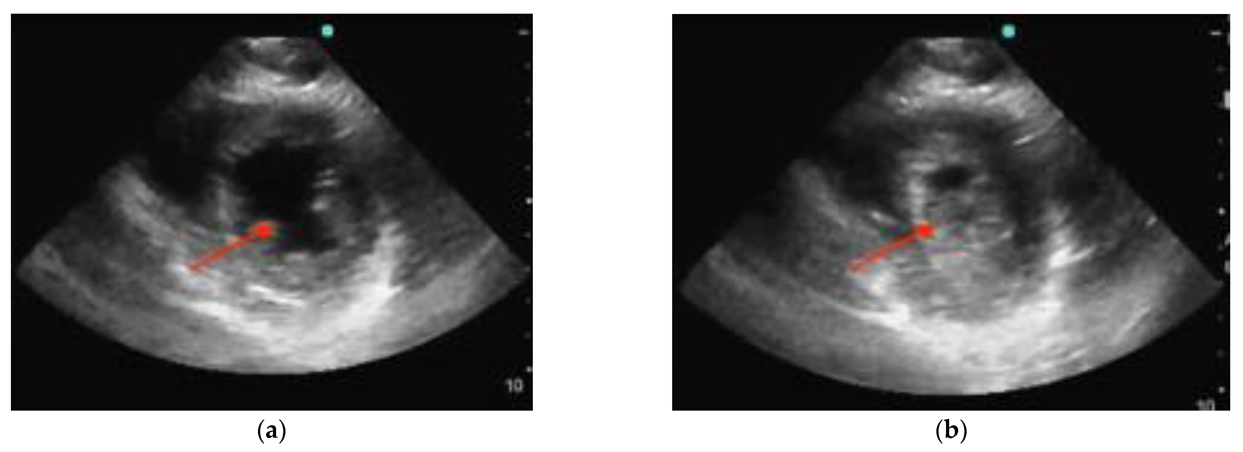 Diagnostics 14 00434 g005 Diagnostics 14 00434 g005
