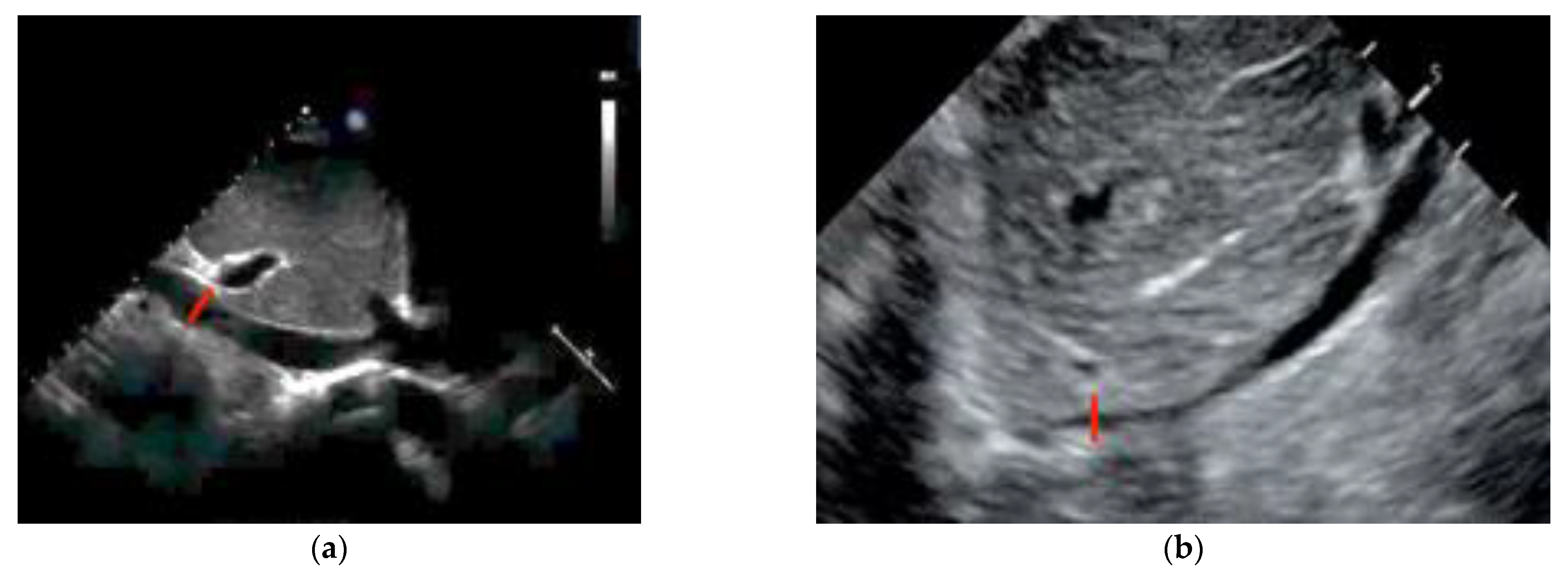 Diagnostics 14 00434 g006 Diagnostics 14 00434 g006