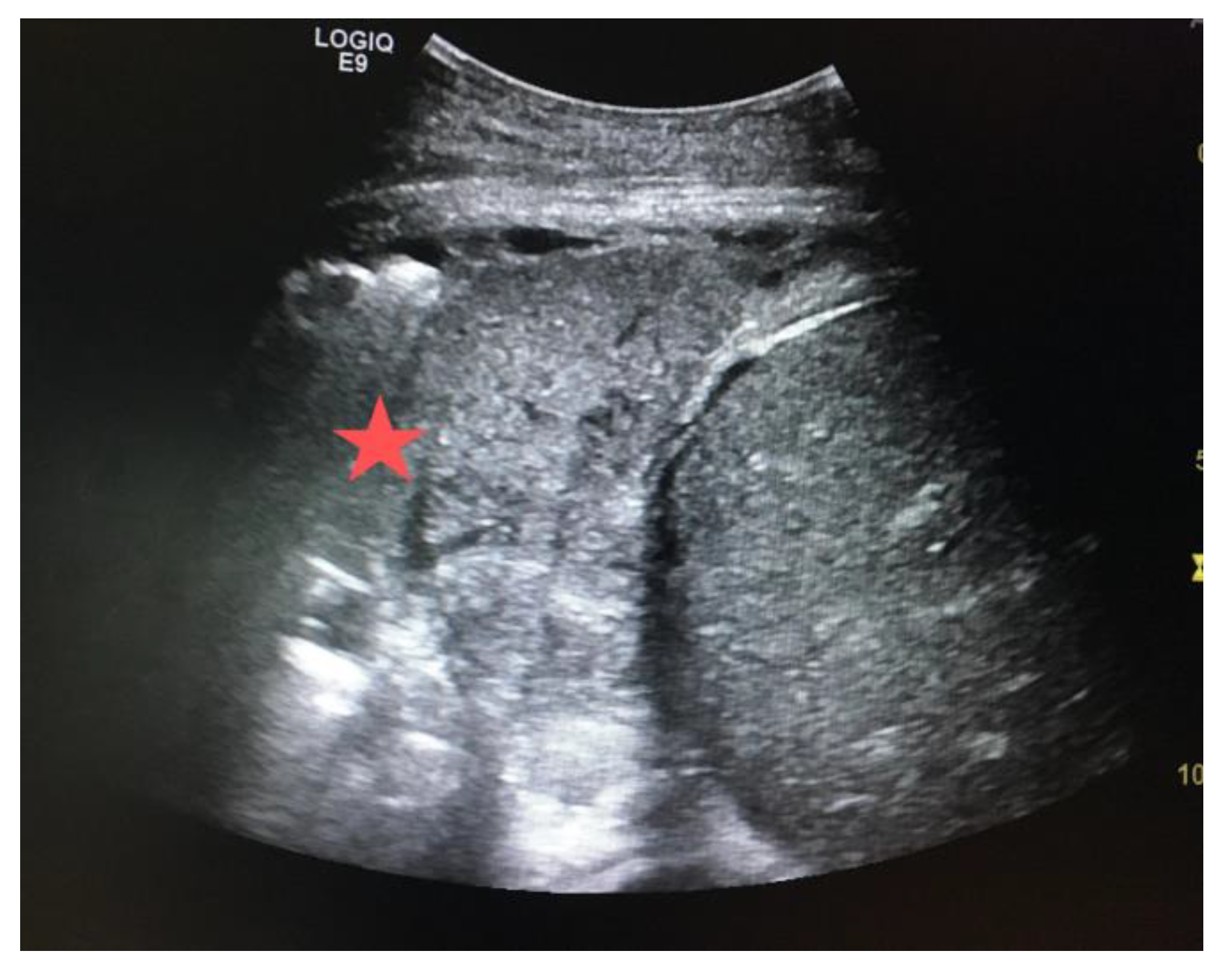 Diagnostics 14 00434 g009 Diagnostics 14 00434 g009