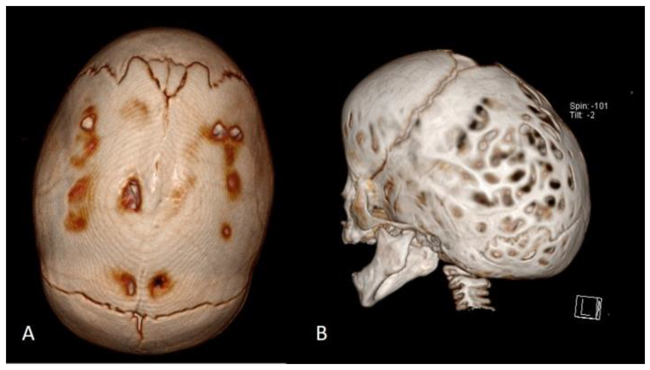 Diagnostics 14 00435 g001