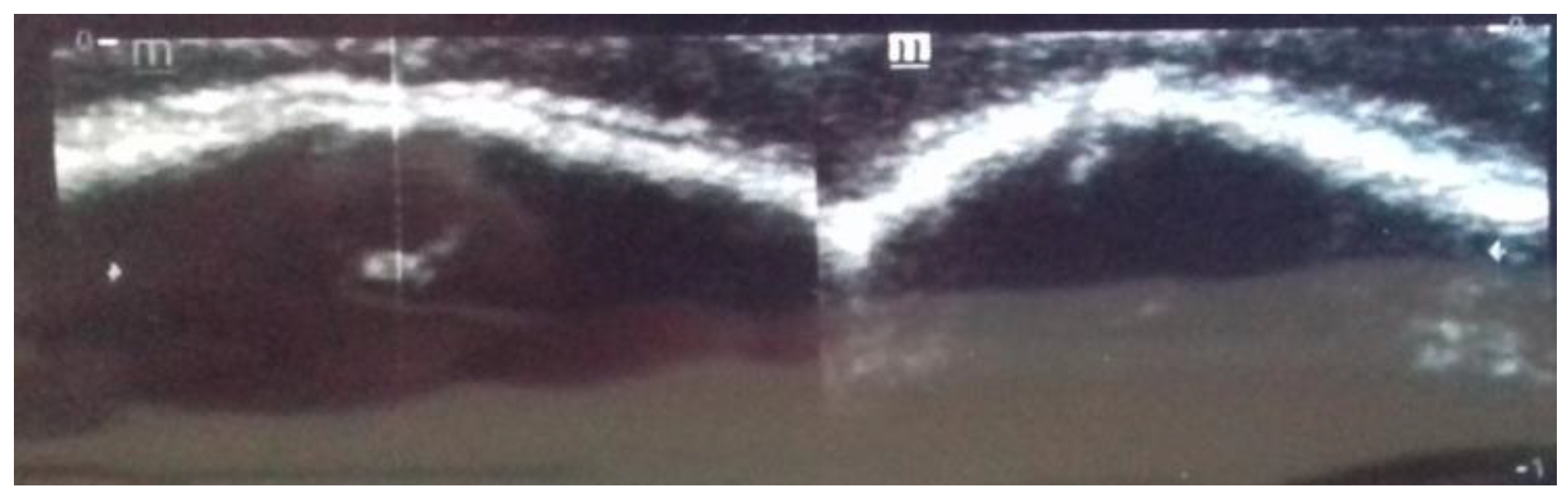 Diagnostics 14 00435 g002