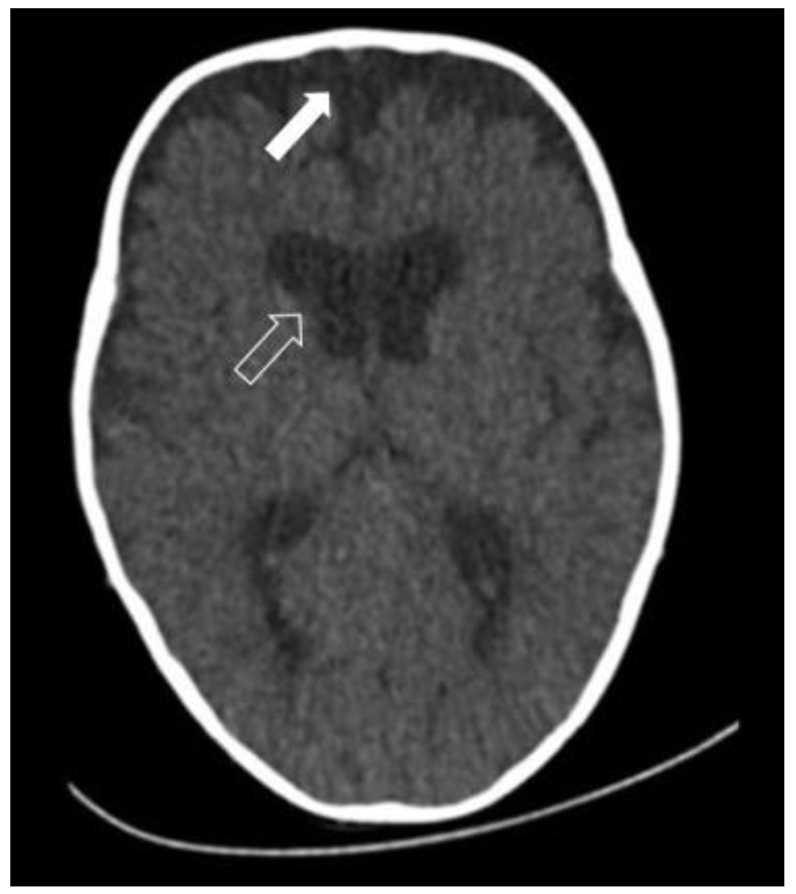 Diagnostics 14 00435 g004