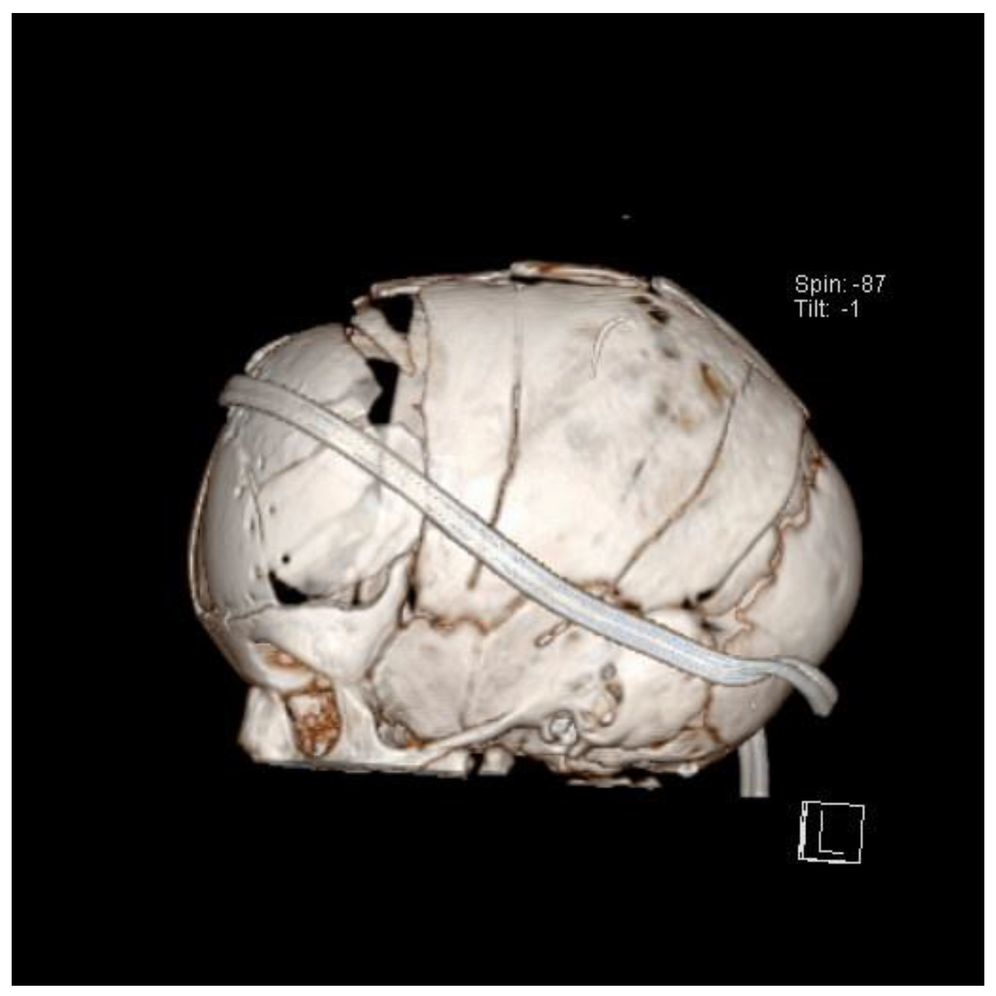Diagnostics 14 00435 g007