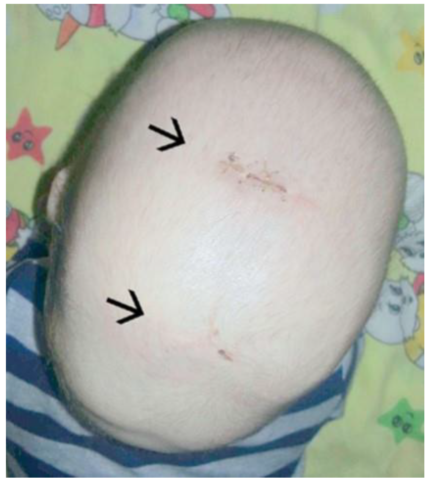 Diagnostics 14 00435 g008