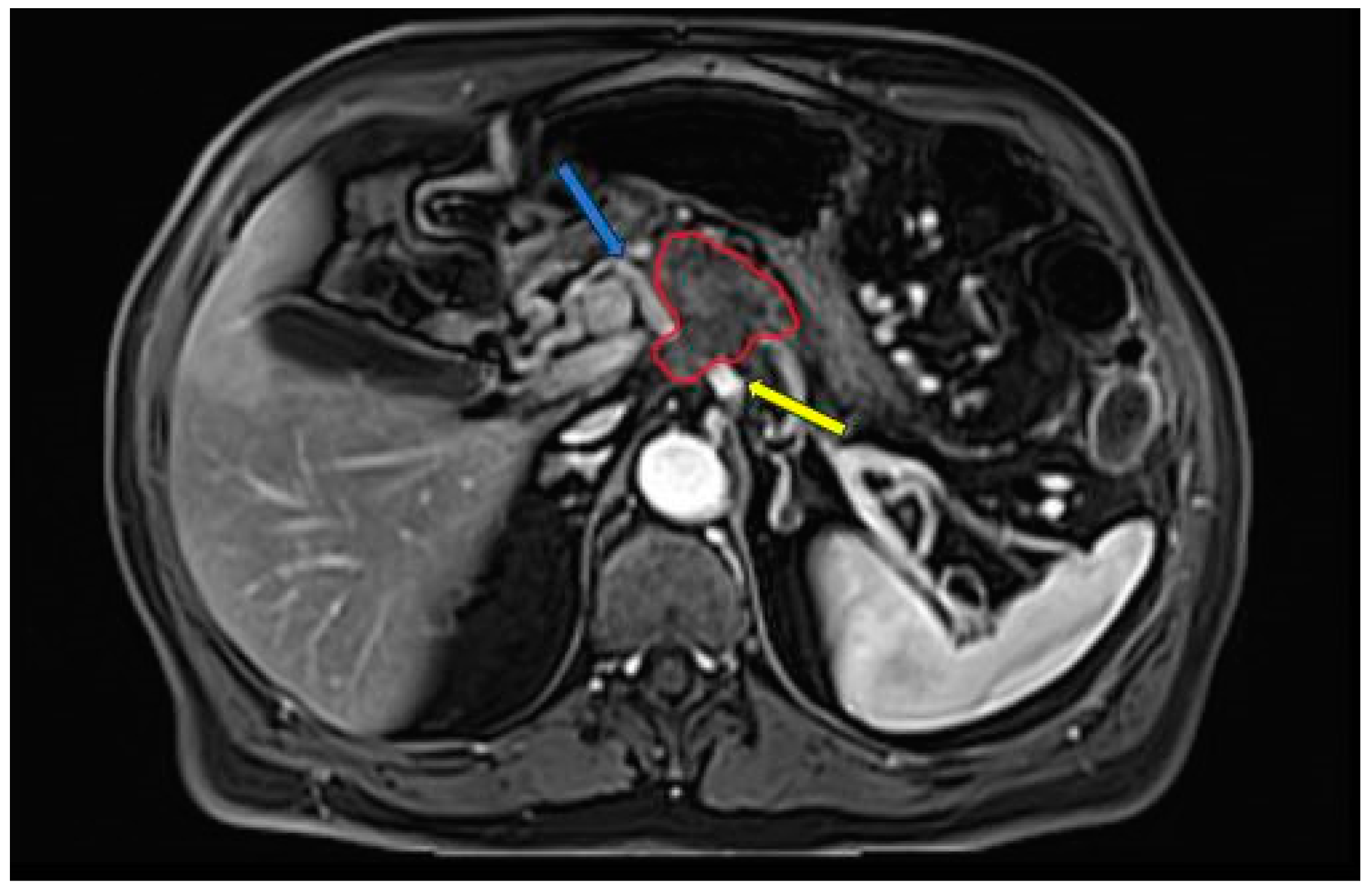 Diagnostics 14 00438 g002