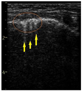 Diagnostics 14 00440 i002