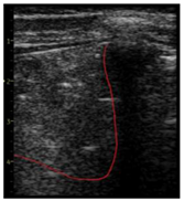 Diagnostics 14 00440 i004