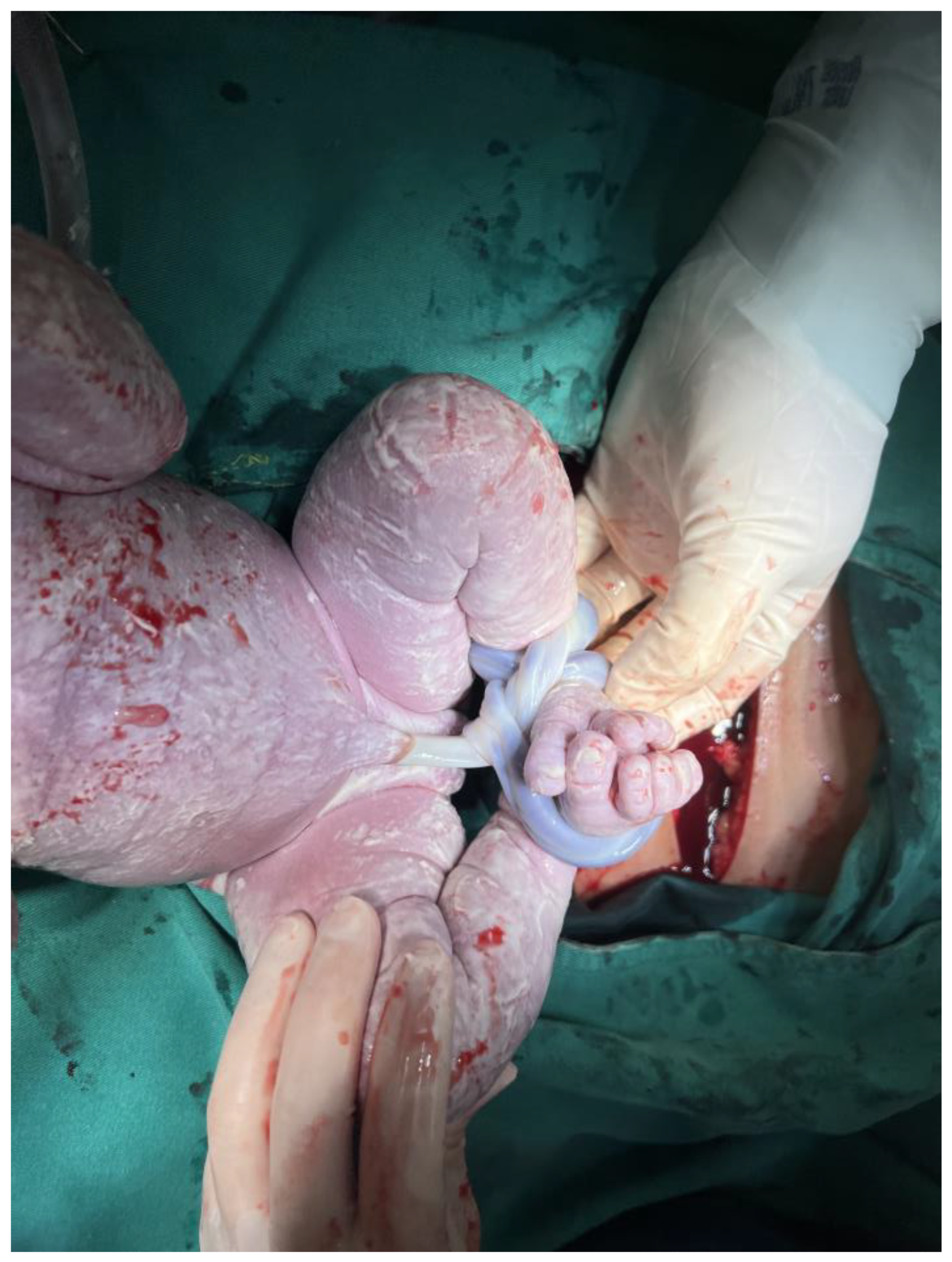 Diagnostics 14 00444 g001