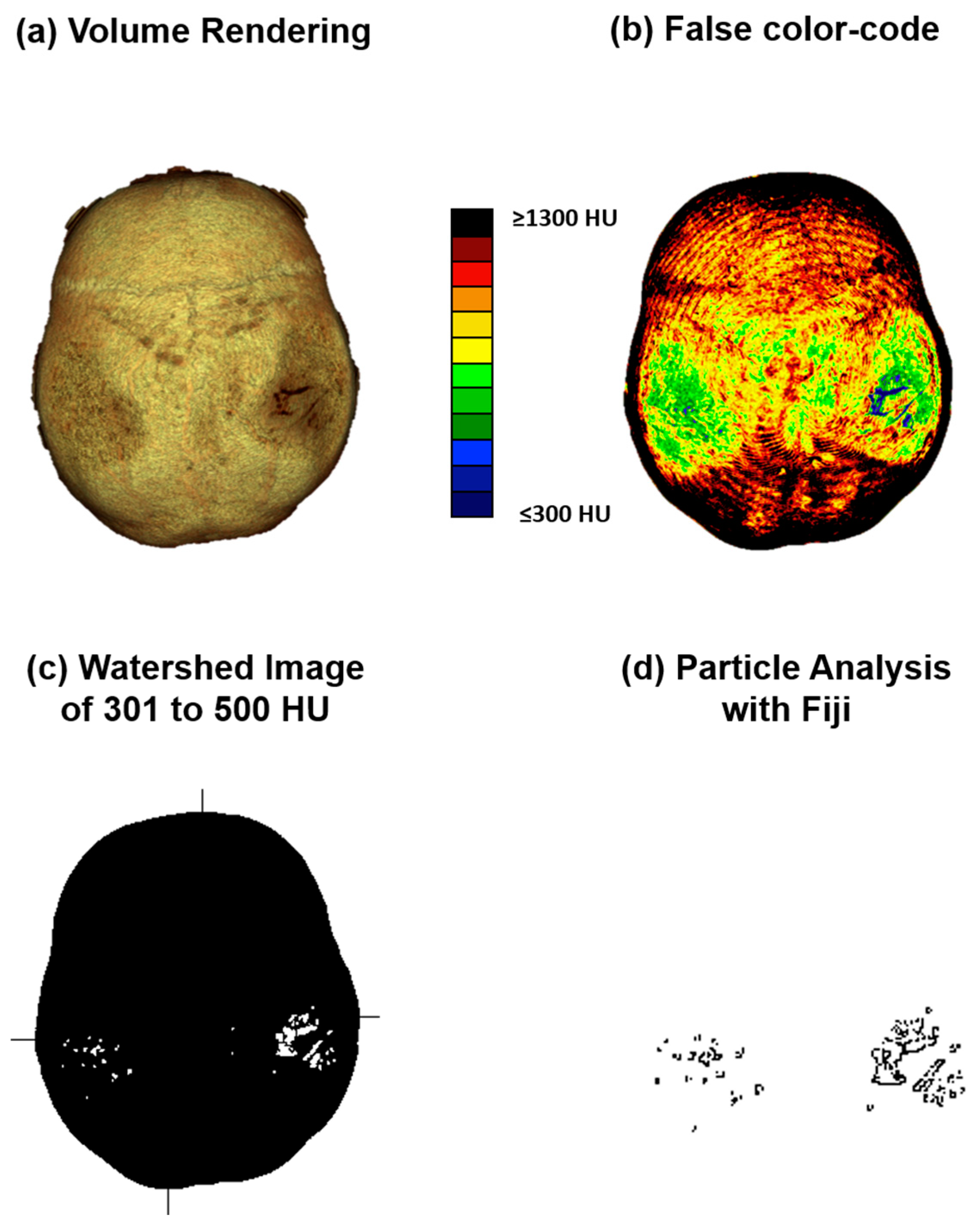 Diagnostics 14 00446 g002 Diagnostics 14 00446 g002