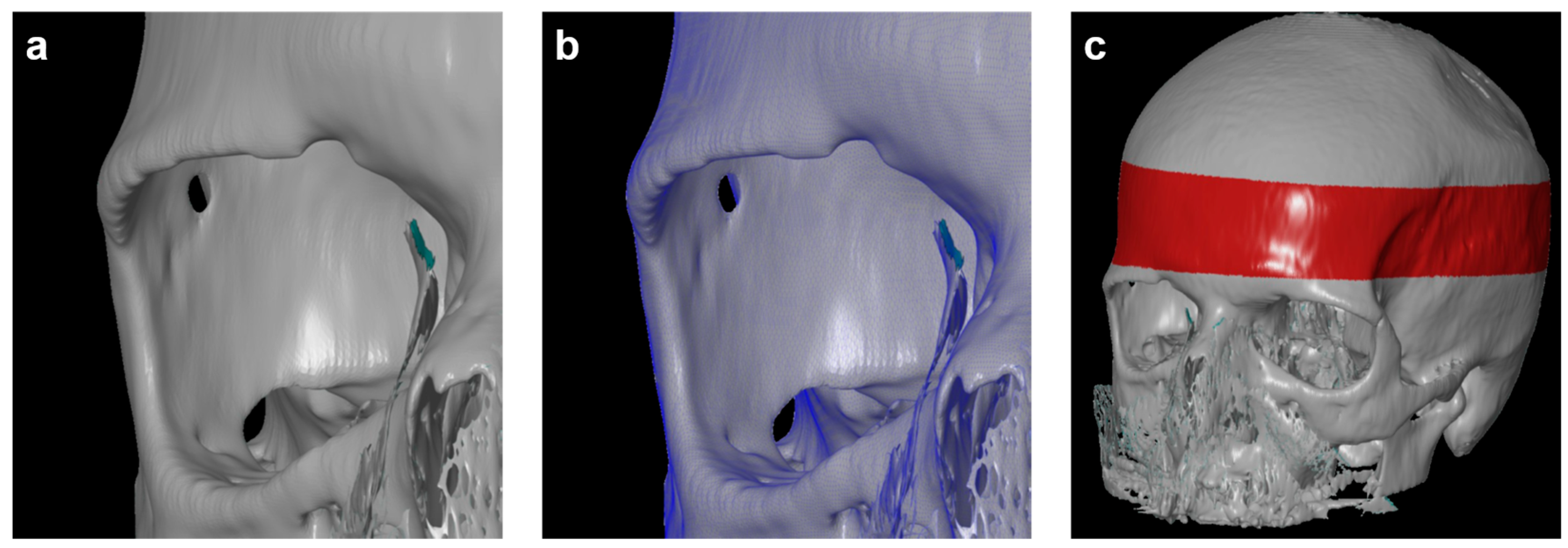 Diagnostics 14 00446 g003 Diagnostics 14 00446 g003