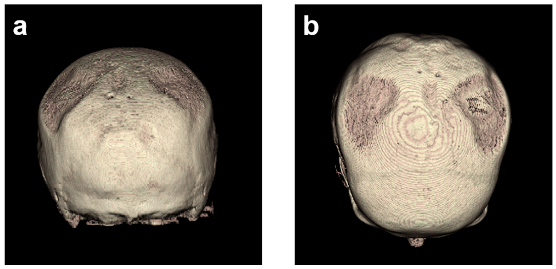 Diagnostics 14 00446 g004 Diagnostics 14 00446 g004