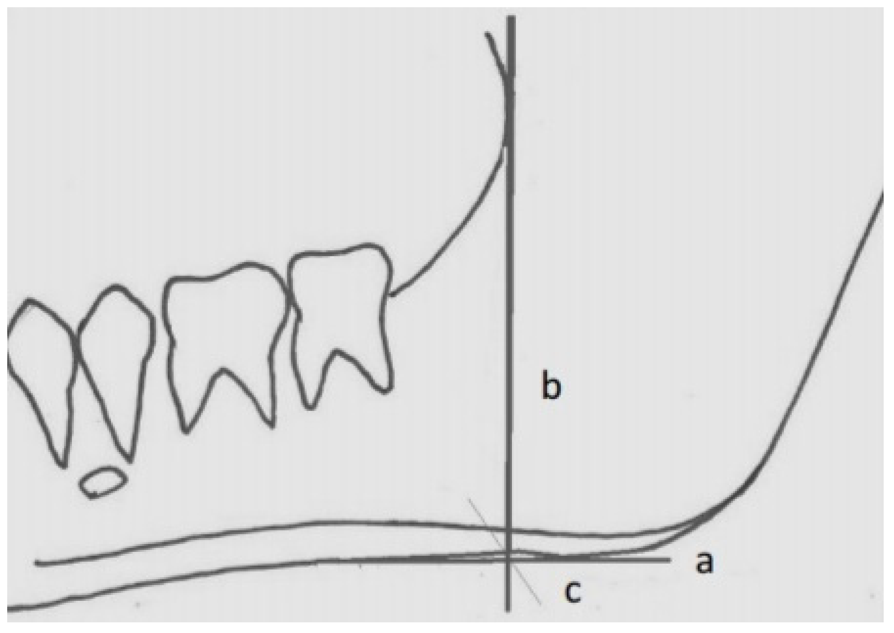 Diagnostics 14 00459 g001
