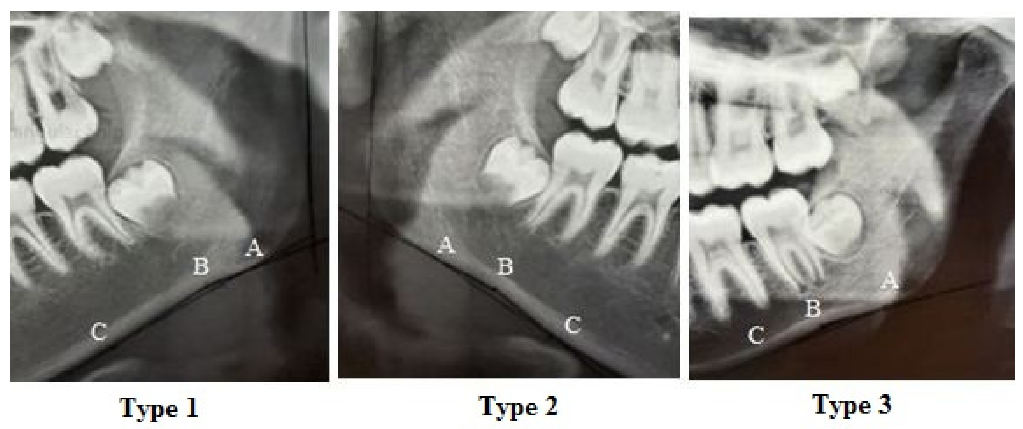 Diagnostics 14 00459 g004